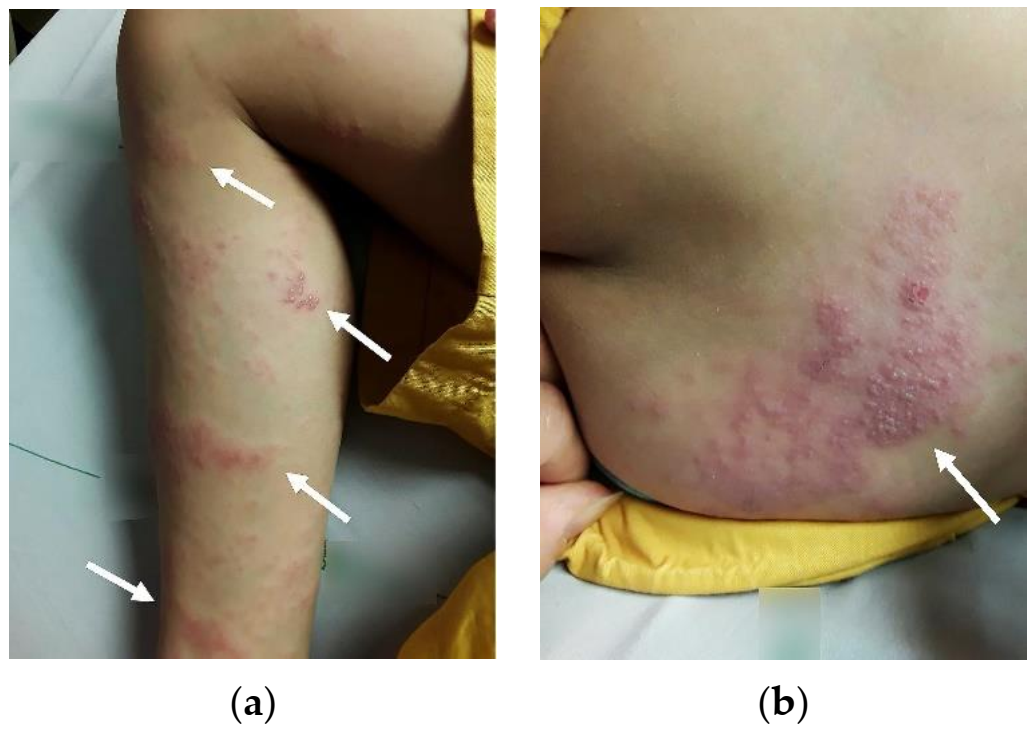 Pediatrrep 13 00022 g001