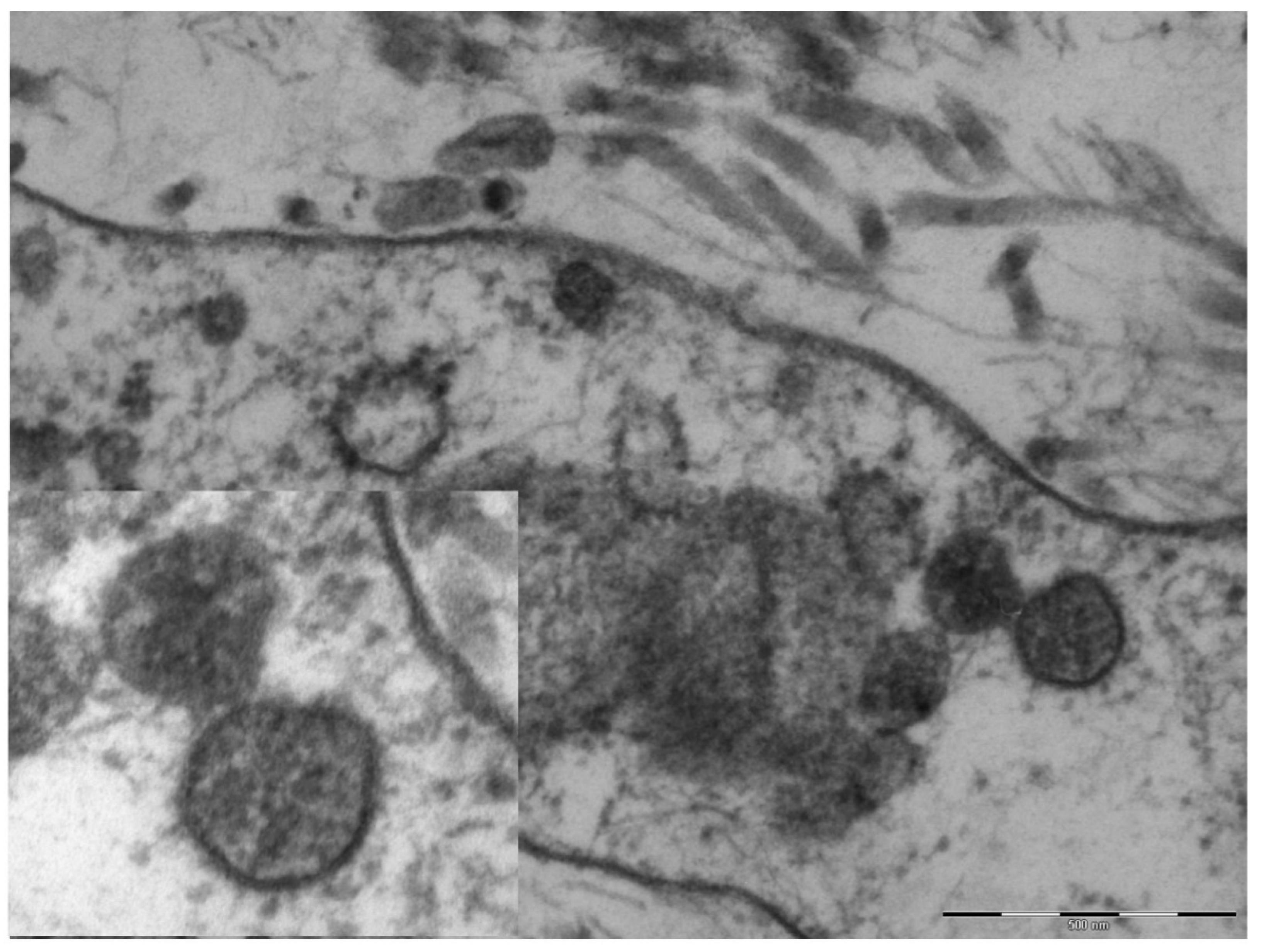 Pediatrrep 13 00025 g004