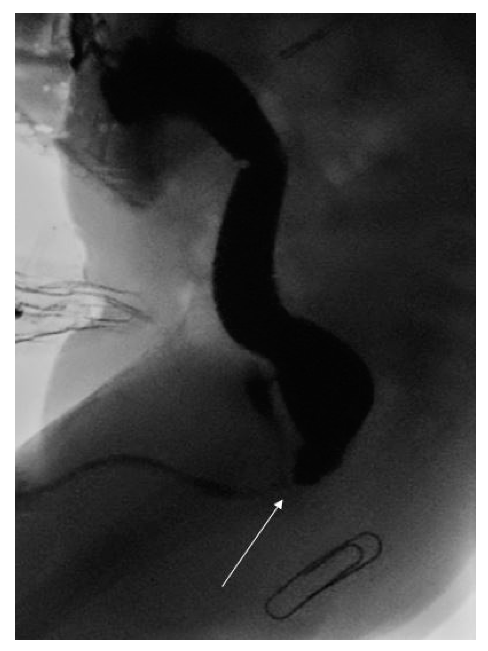 Pediatrrep 13 00026 g001 Pediatrrep 13 00026 g001