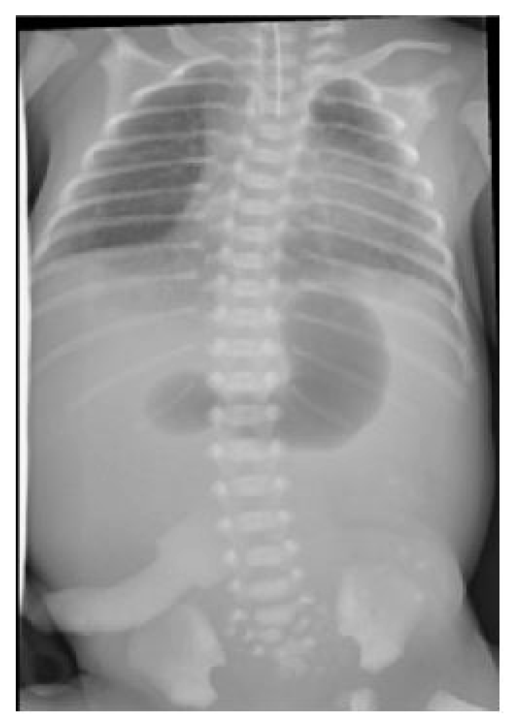 Pediatrrep 13 00026 g002 Pediatrrep 13 00026 g002