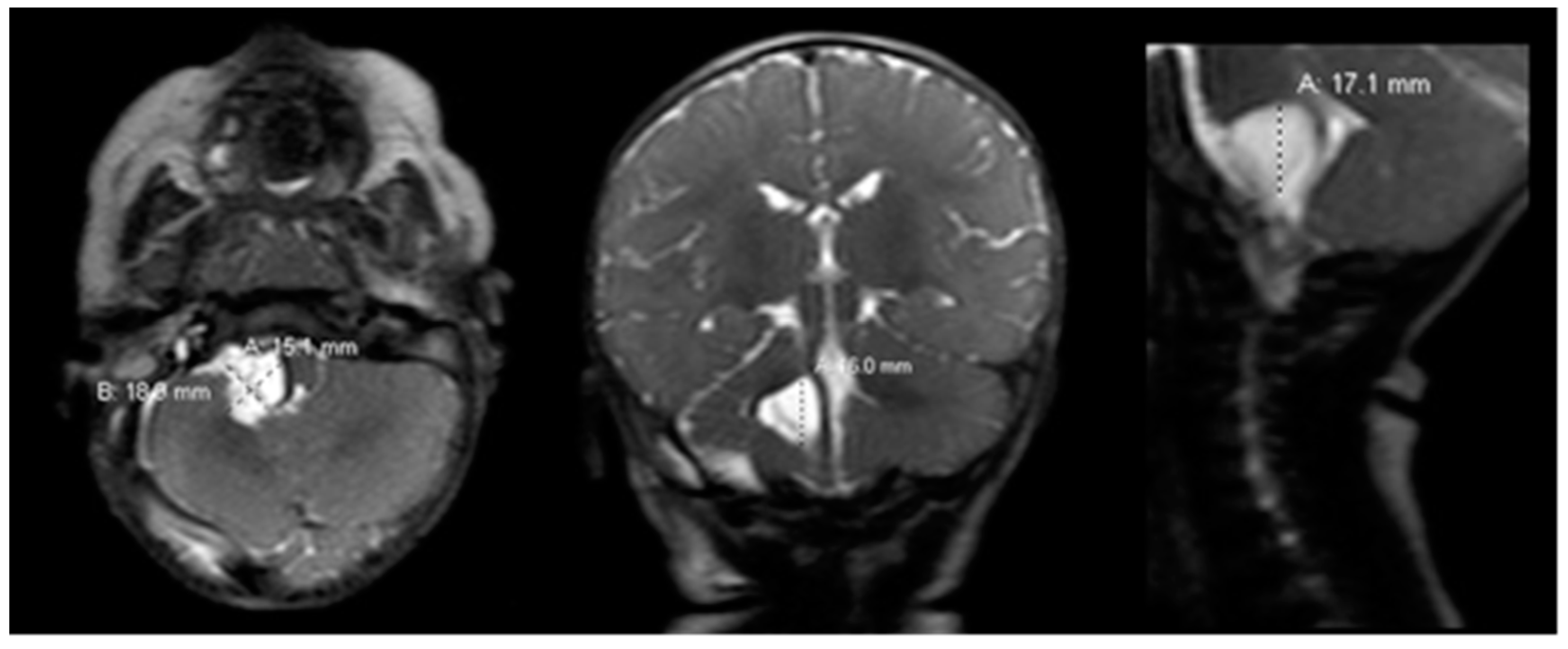 Pediatrrep 13 00027 g002 Pediatrrep 13 00027 g002