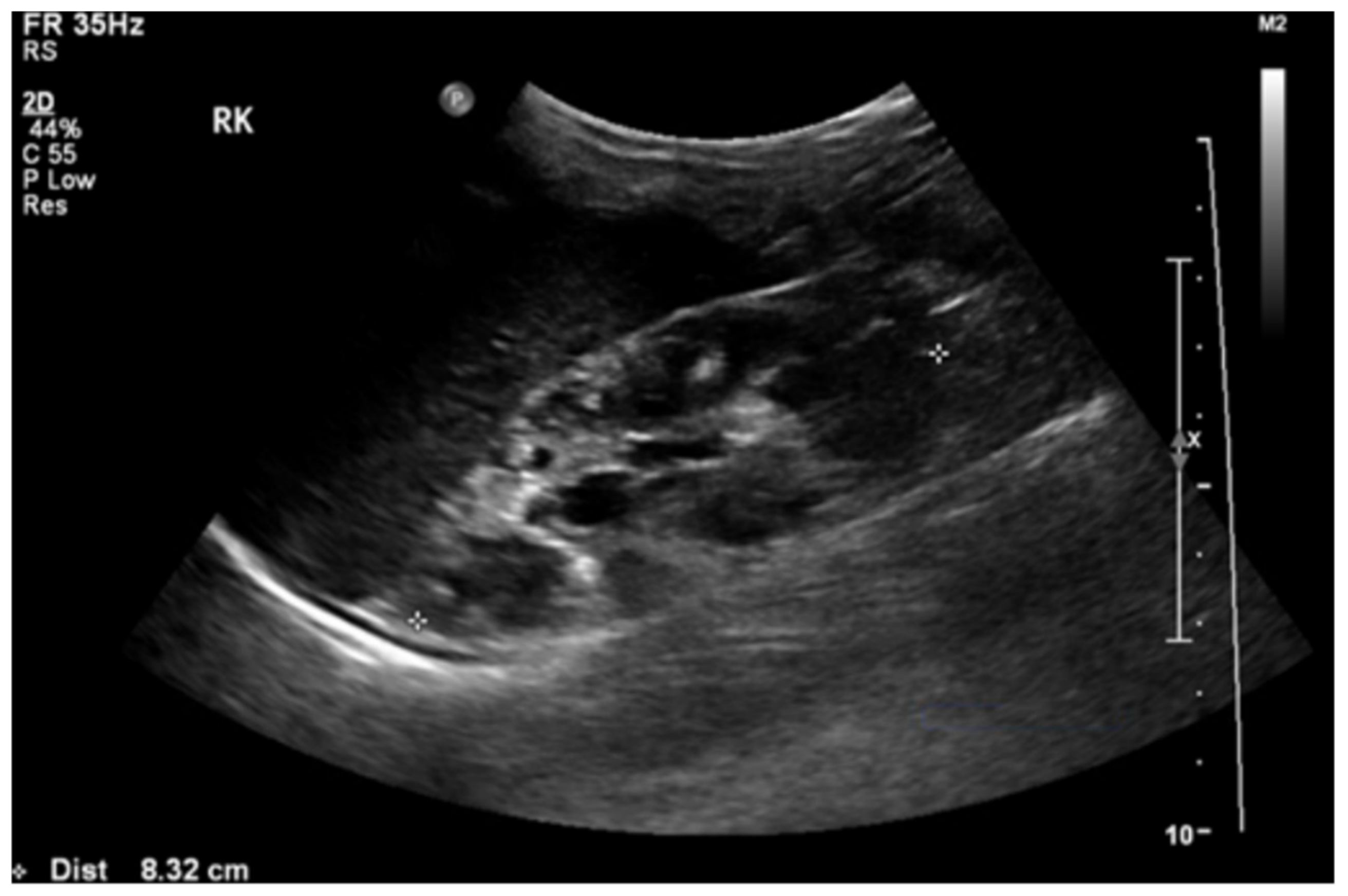 Pediatrrep 13 00028 g002