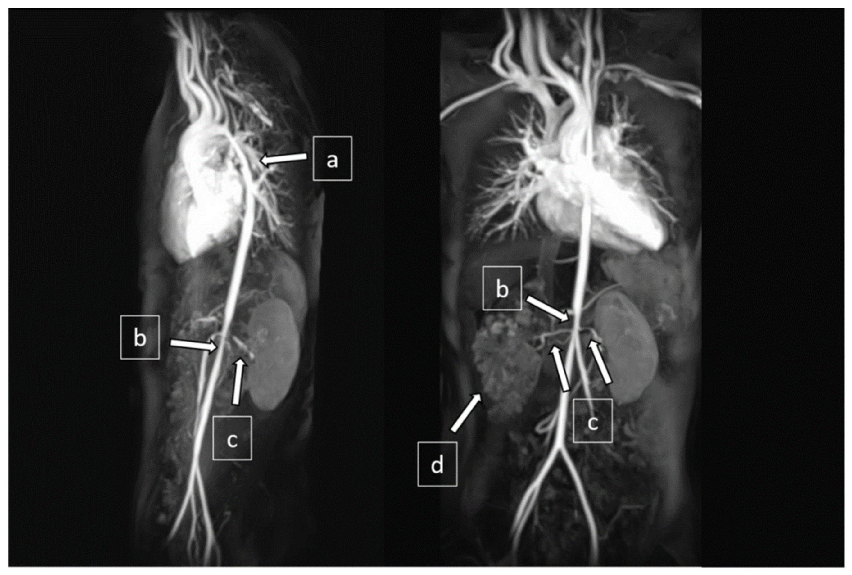 Pediatrrep 13 00028 g003