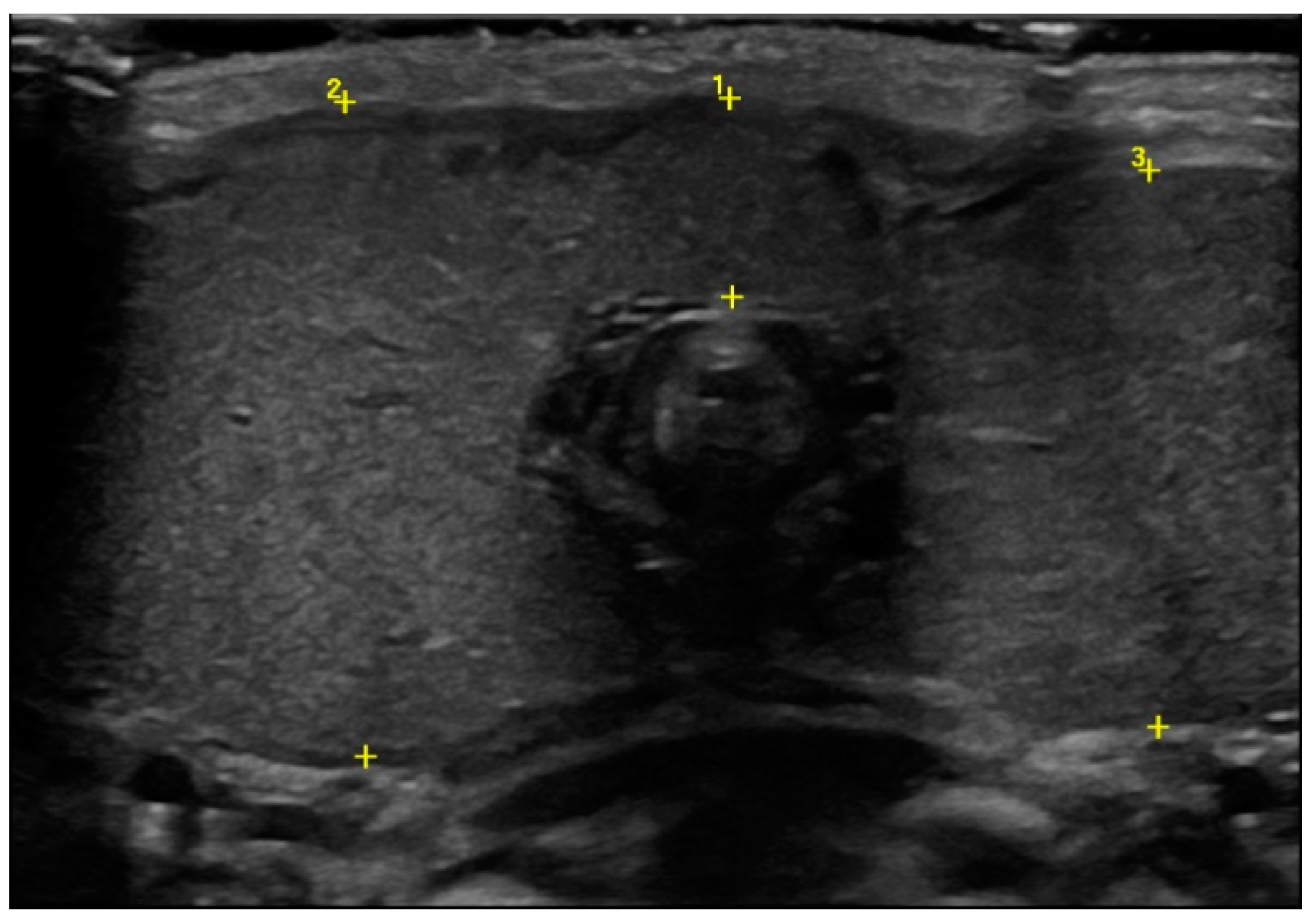 Pediatrrep 13 00029 g002