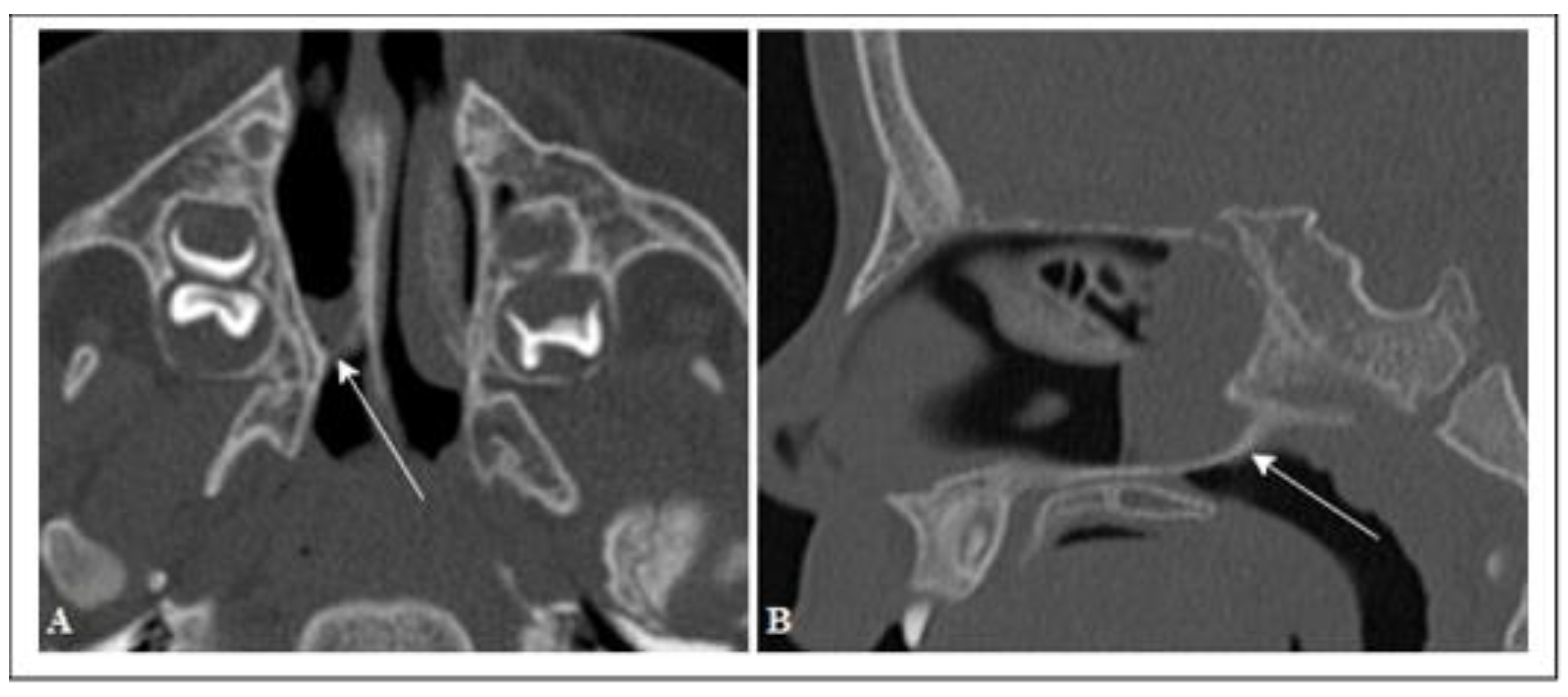 Pediatrrep 13 00038 g002 Pediatrrep 13 00038 g002