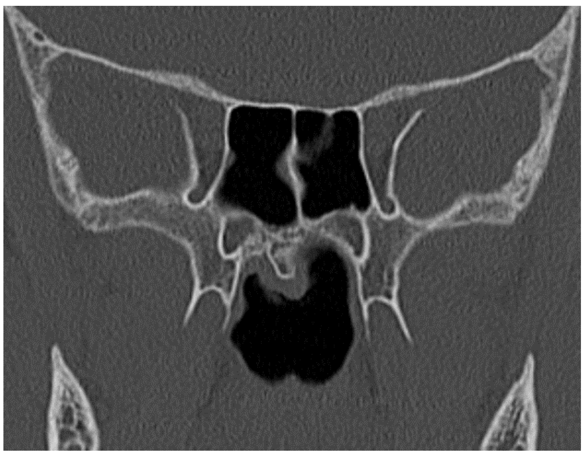 Pediatrrep 13 00038 g003 Pediatrrep 13 00038 g003