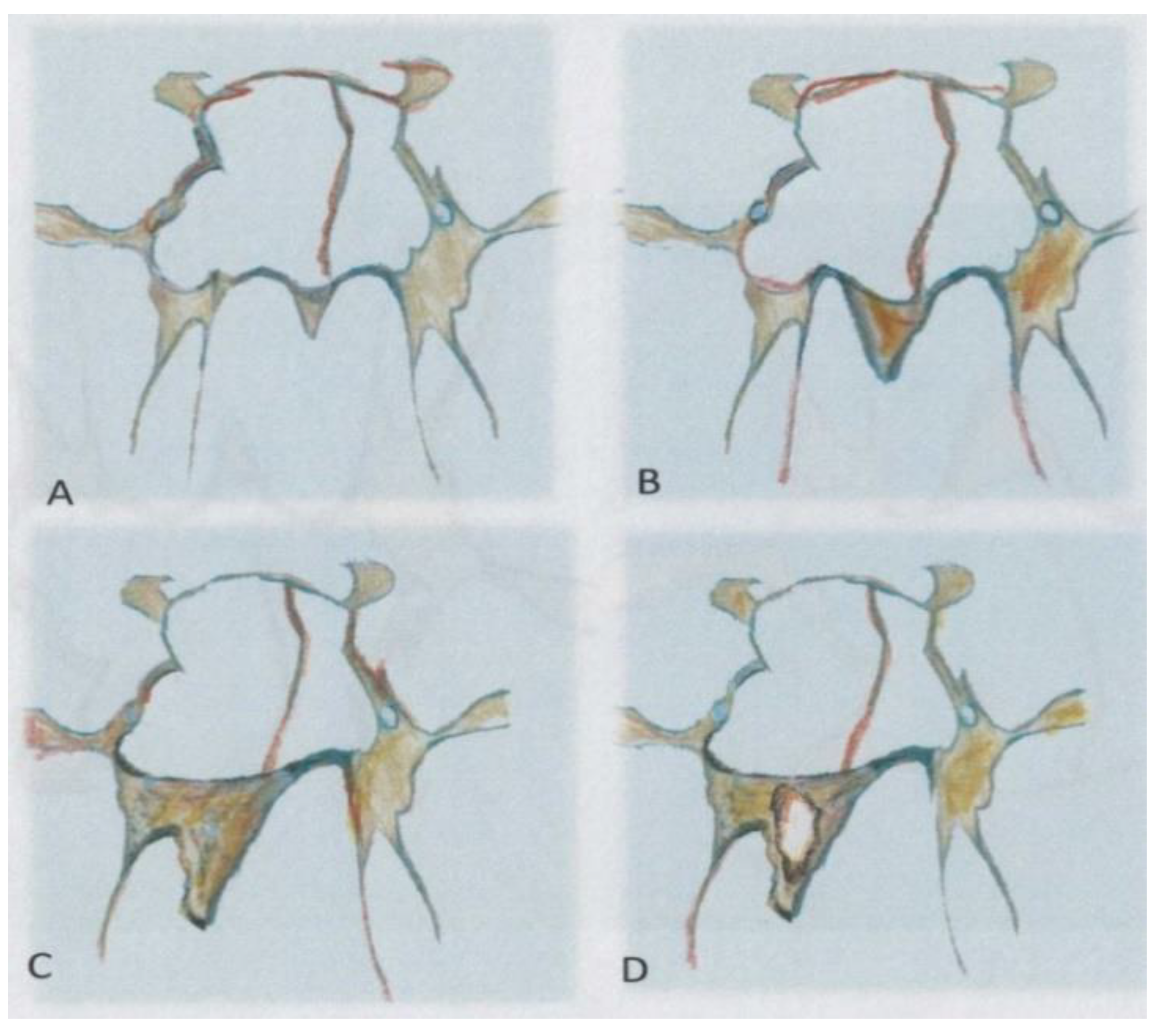 Pediatrrep 13 00038 g004 Pediatrrep 13 00038 g004