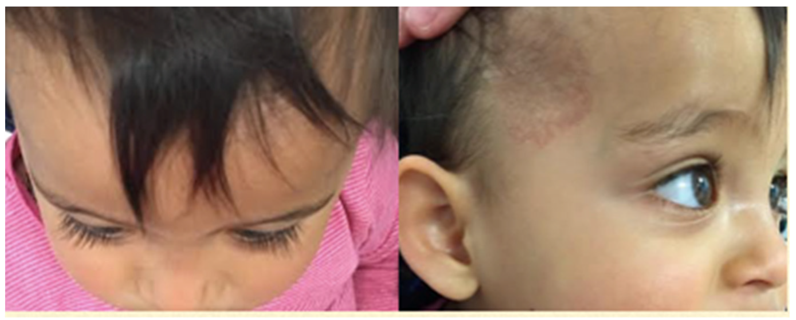 Pediatrrep 13 00043 g003