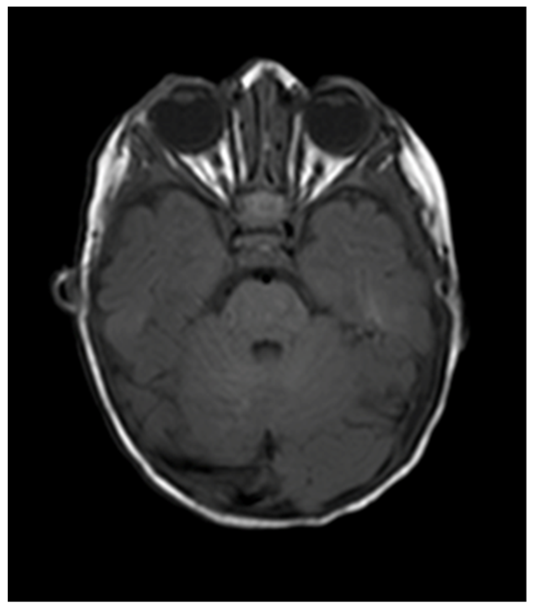 Pediatrrep 13 00043 g004