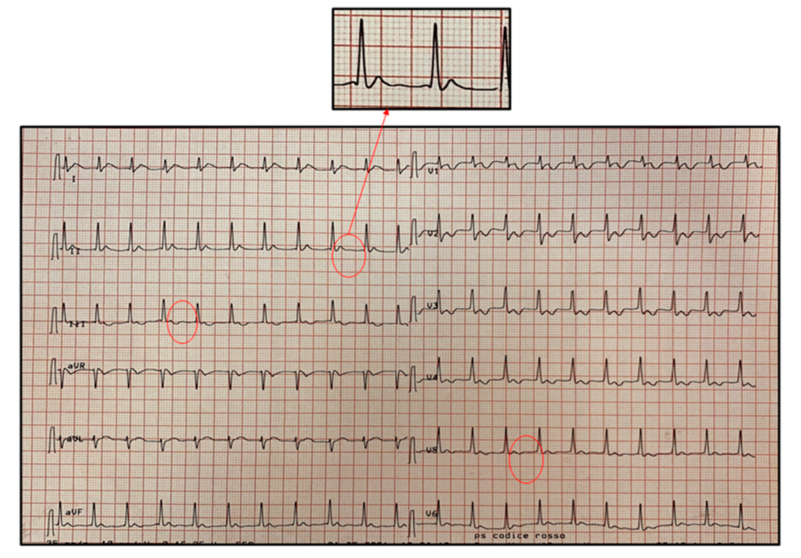 Pediatrrep 13 00058 g004