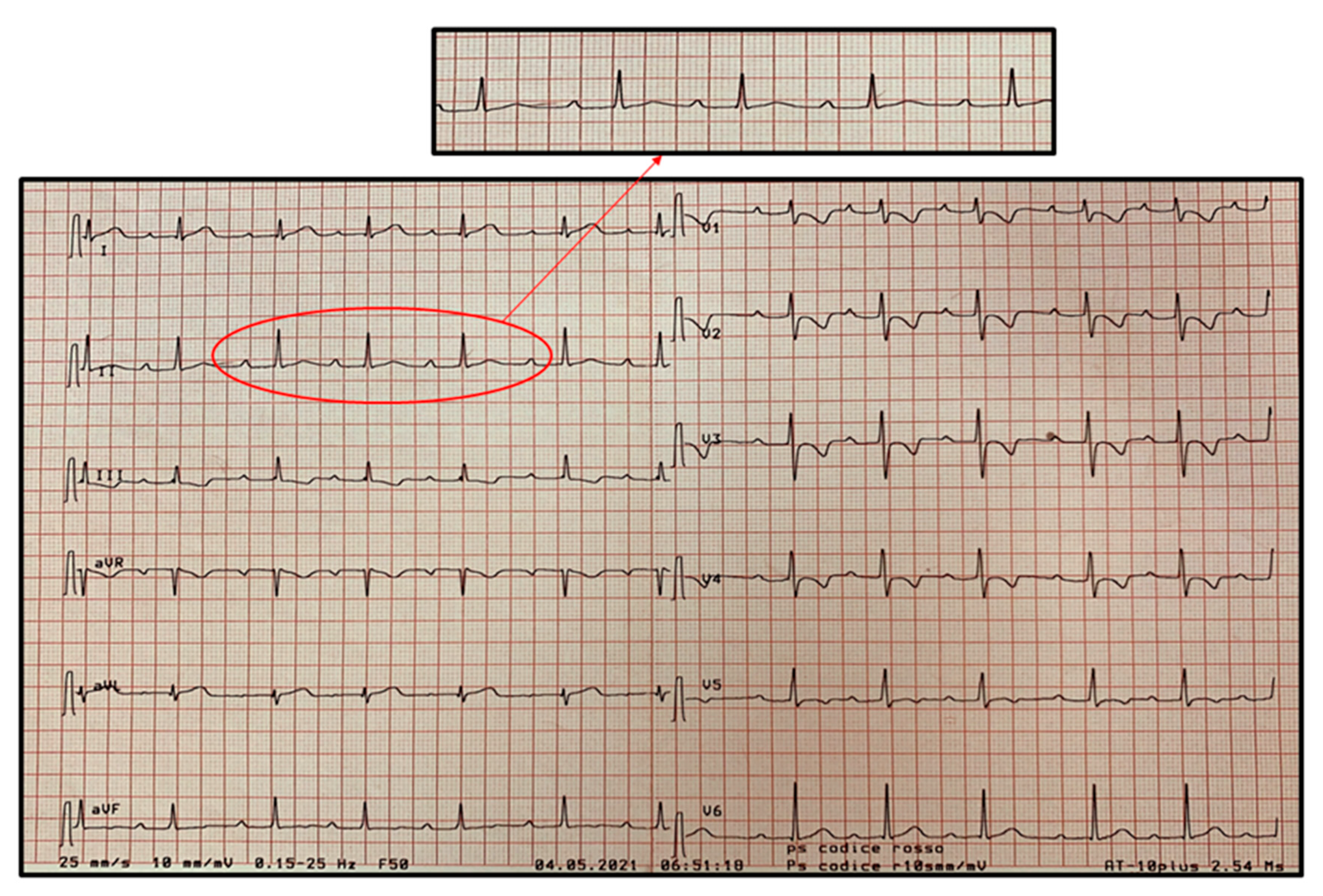 Pediatrrep 13 00058 g005