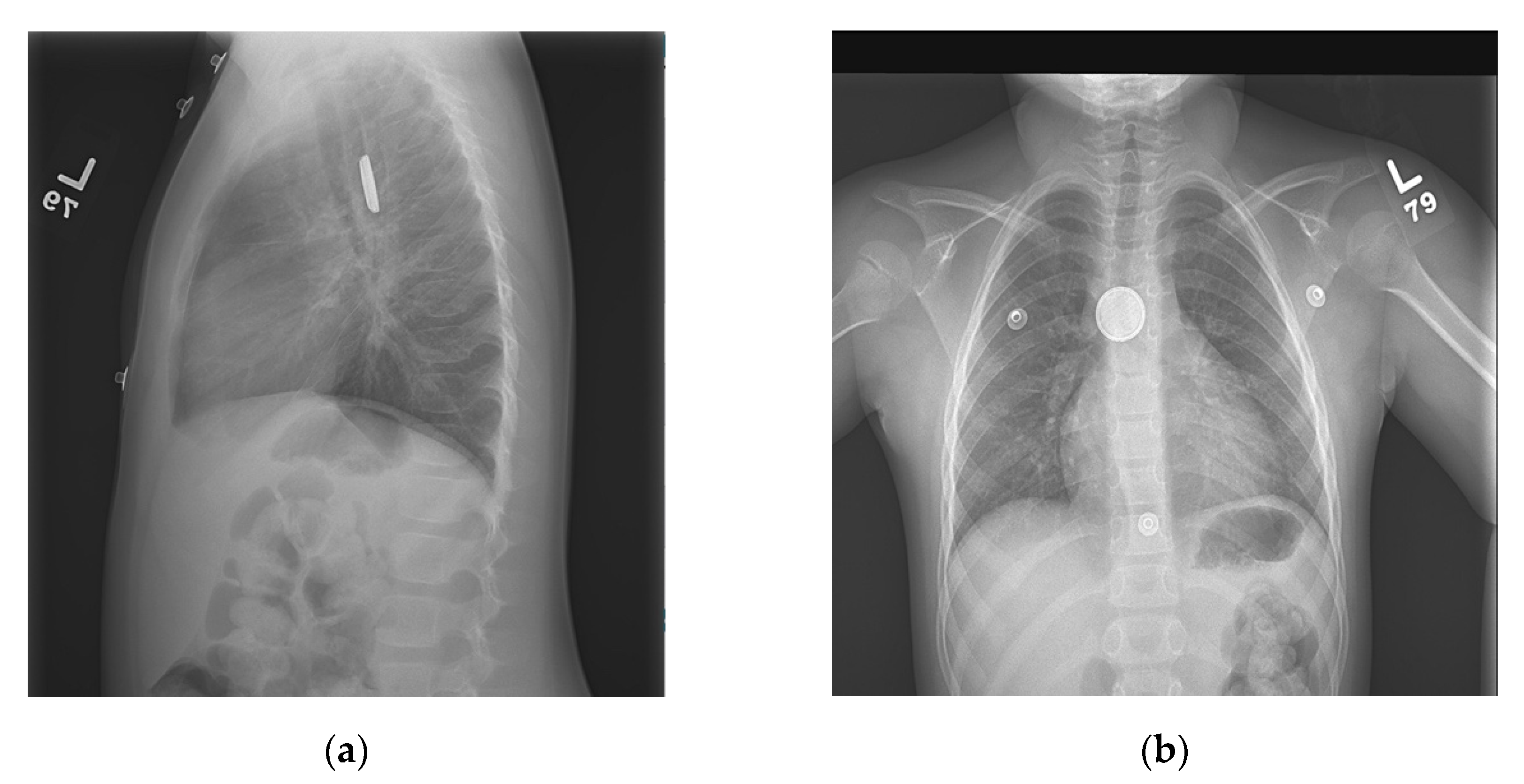 Pediatrrep 13 00059 g001 Pediatrrep 13 00059 g001