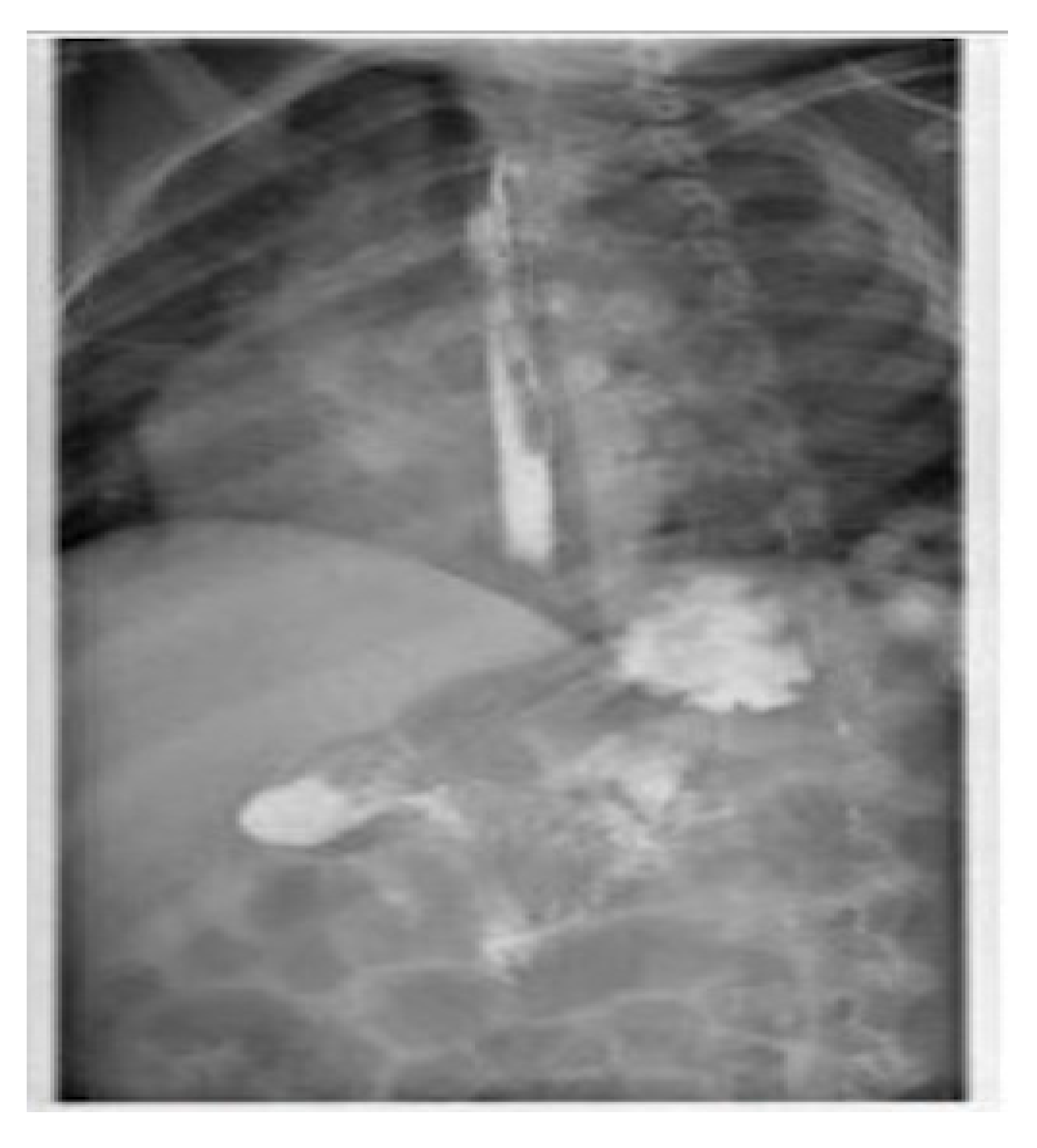Pediatrrep 13 00059 g004 Pediatrrep 13 00059 g004