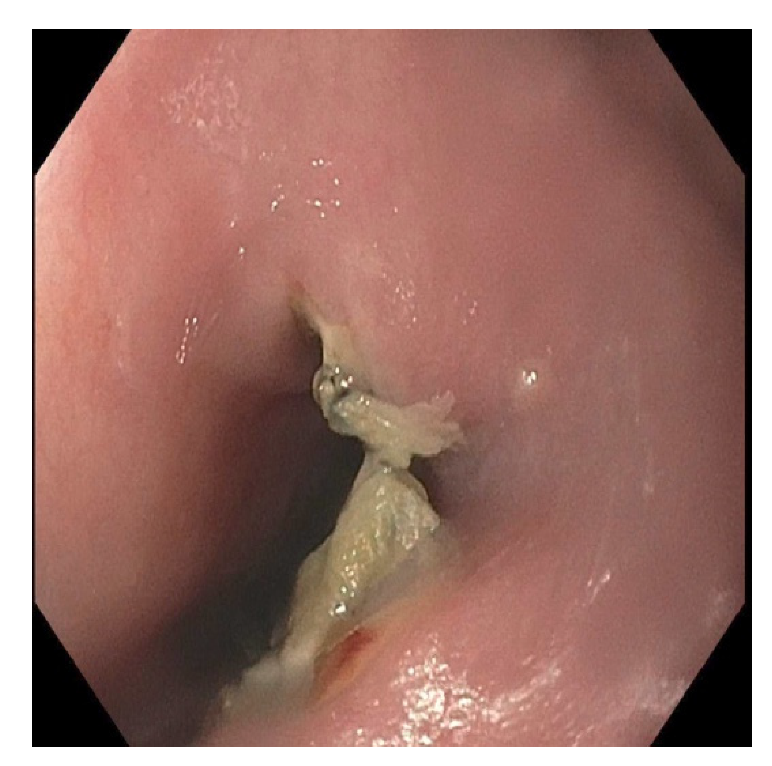 Pediatrrep 13 00059 g005 Pediatrrep 13 00059 g005