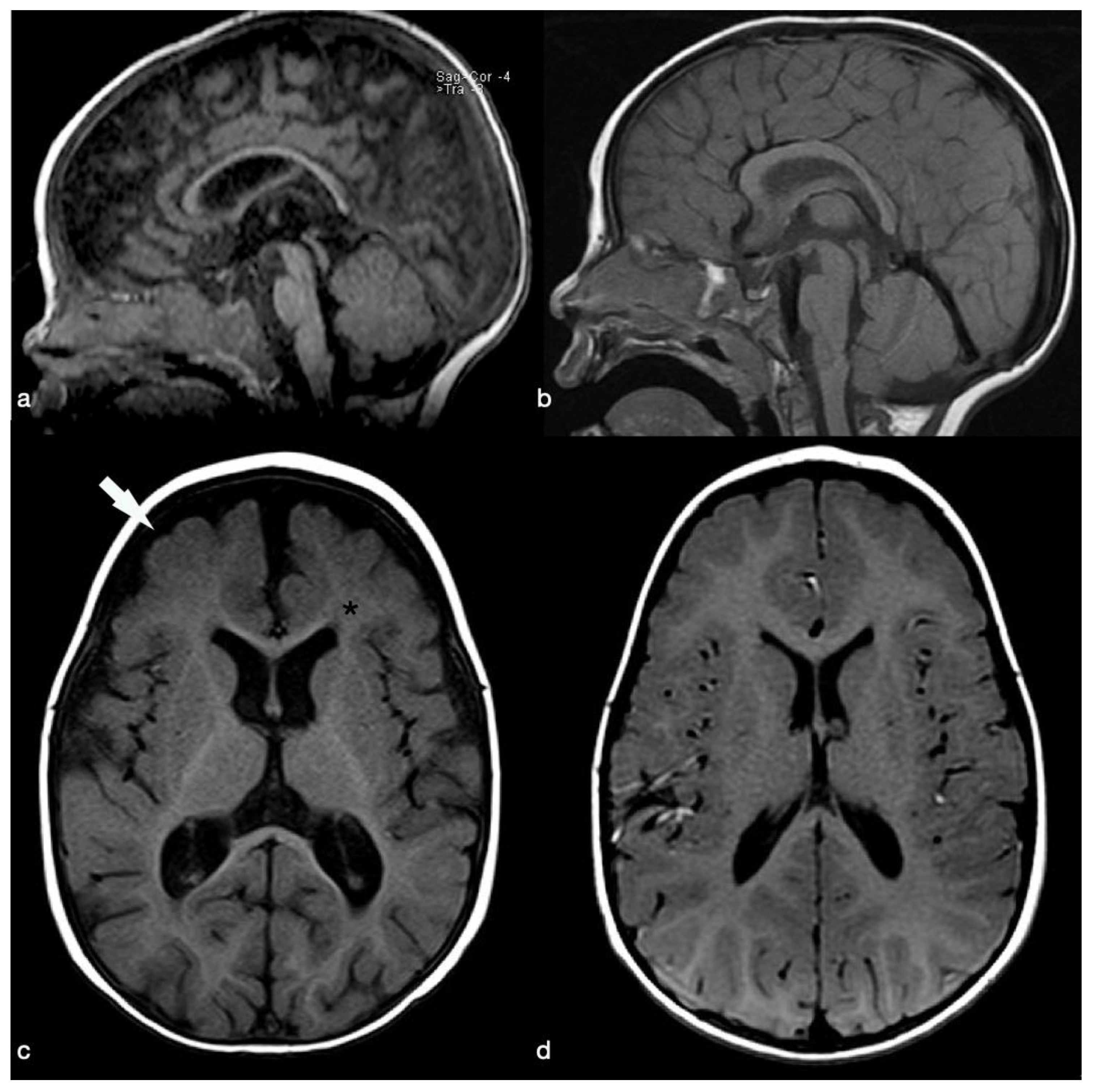 Pediatrrep 13 00069 g002