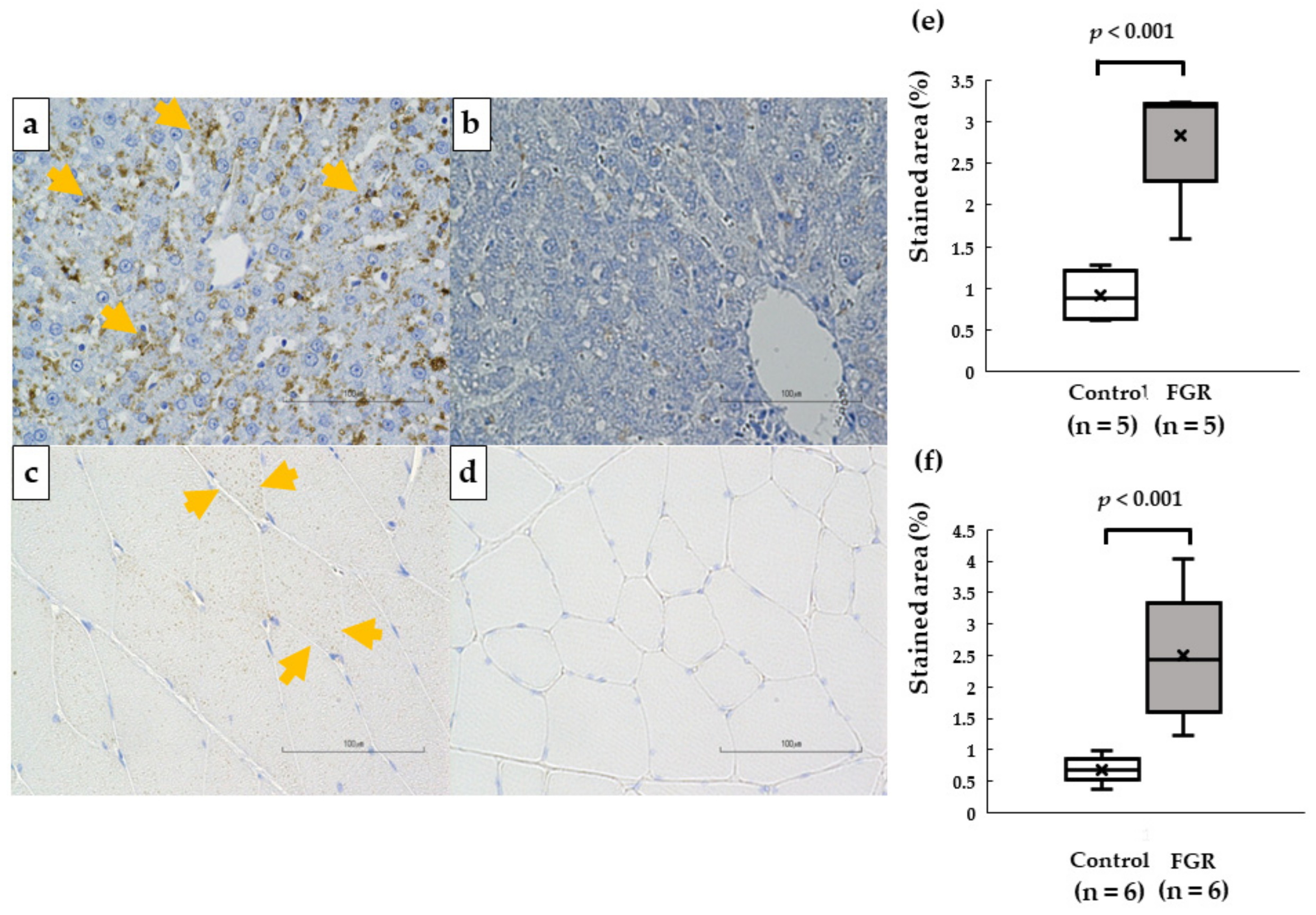Pediatrrep 15 00006 g006