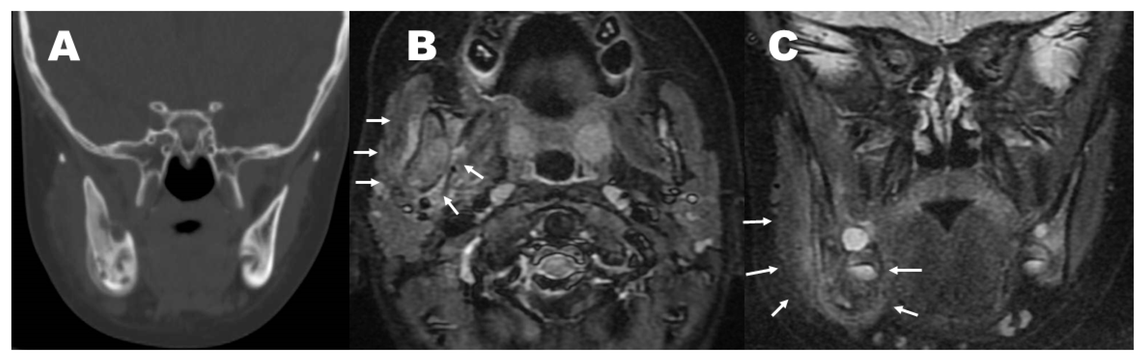 Pediatrrep 15 00016 g001