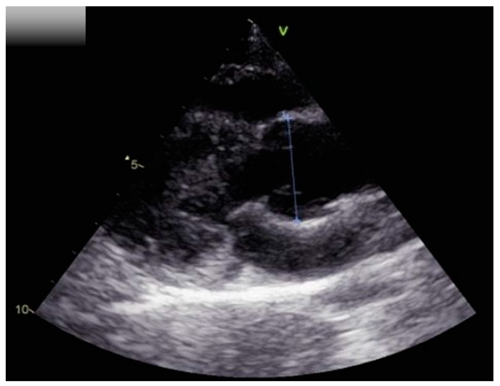 Pediatrrep 15 00019 g002