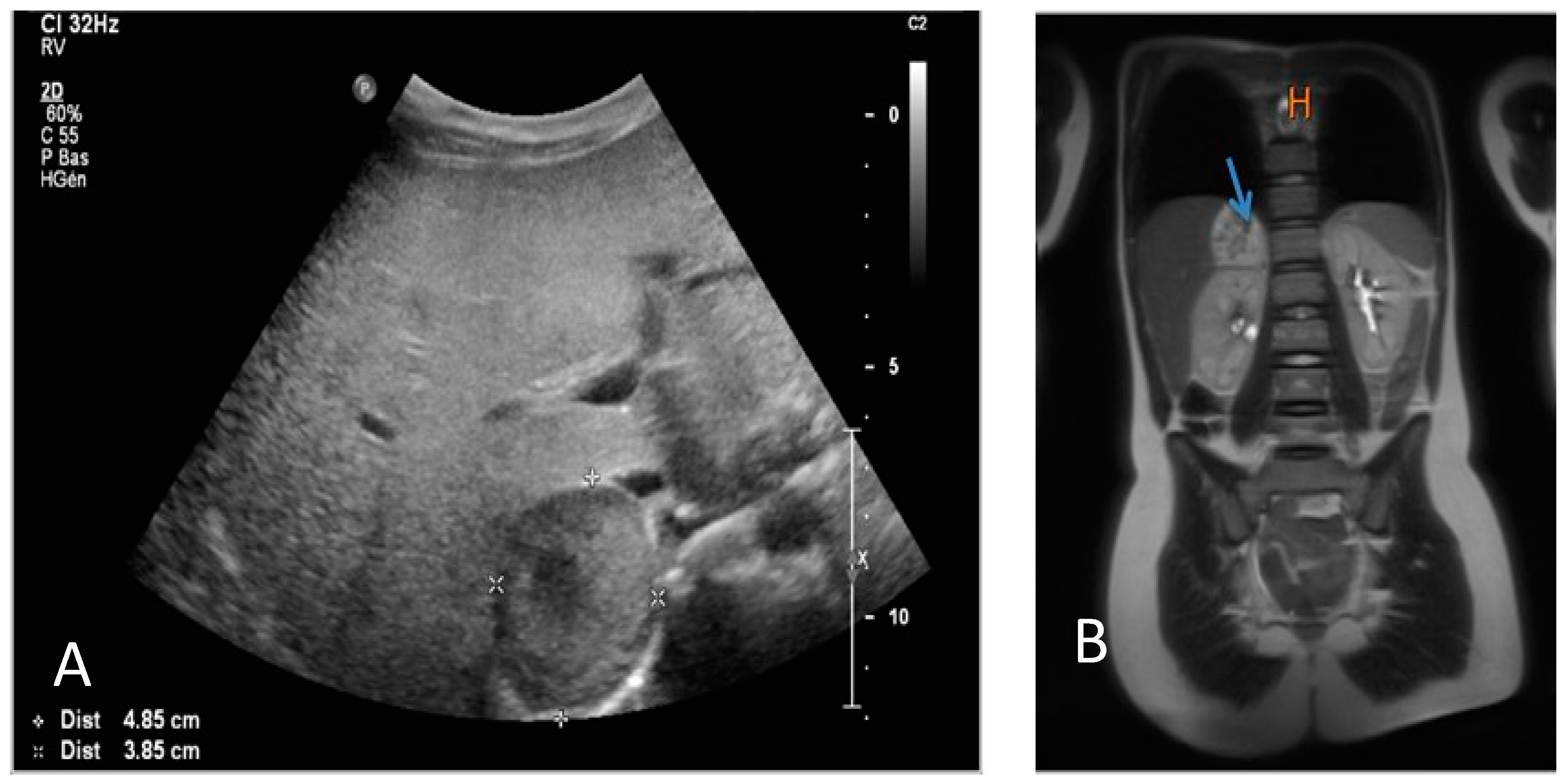 Pediatrrep 15 00019 g003