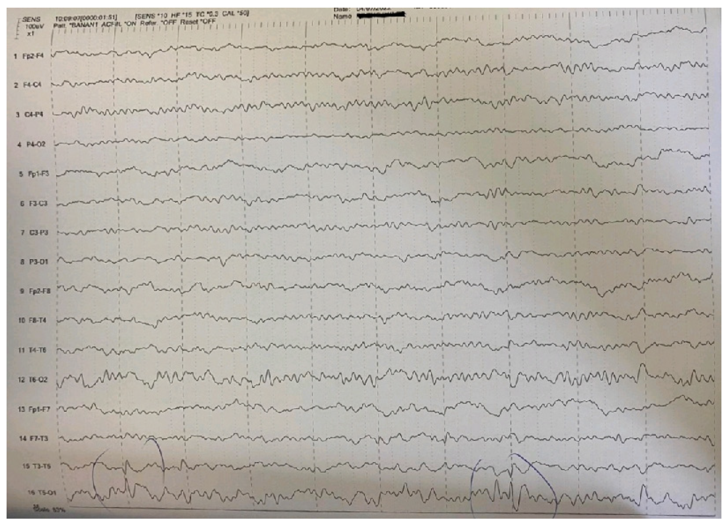 Pediatrrep 15 00045 g002 Pediatrrep 15 00045 g002