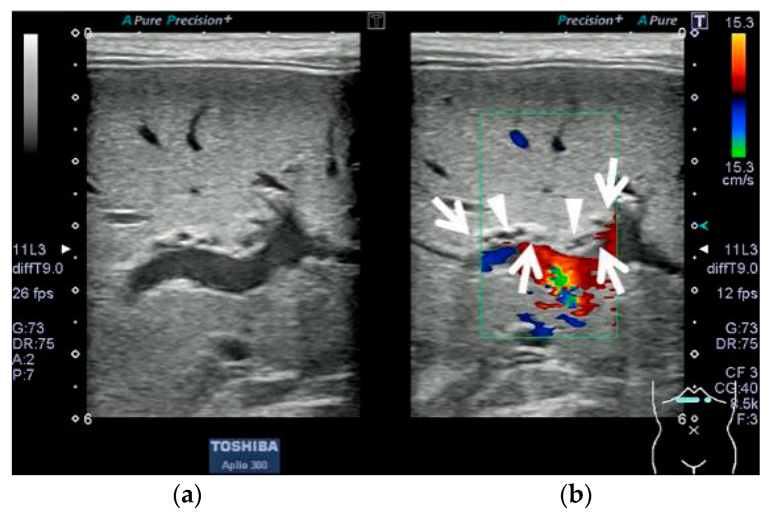 Pediatrrep 15 00049 g001