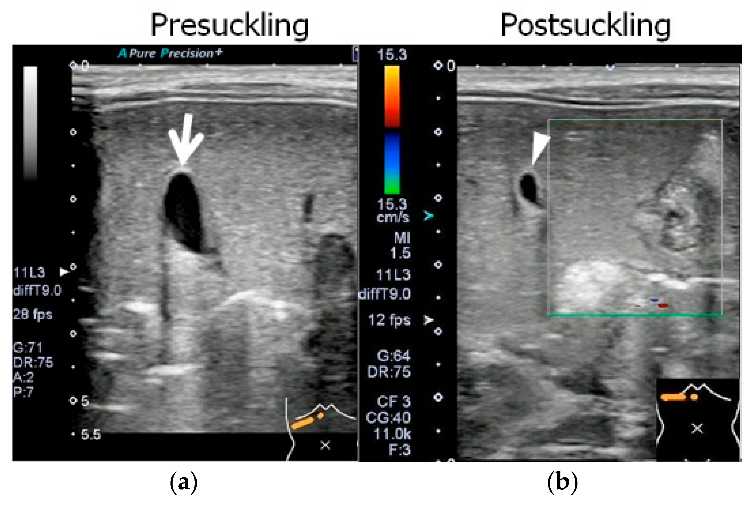 Pediatrrep 15 00049 g002