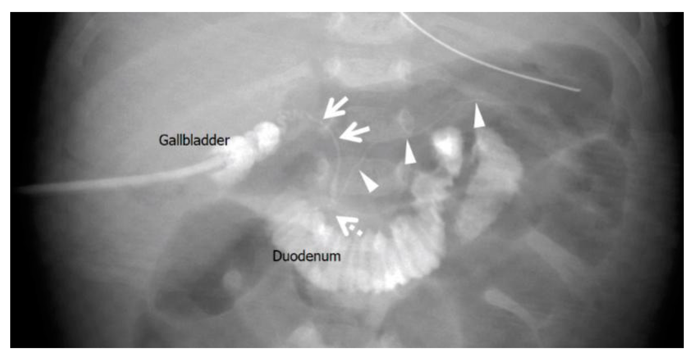 Pediatrrep 15 00049 g003
