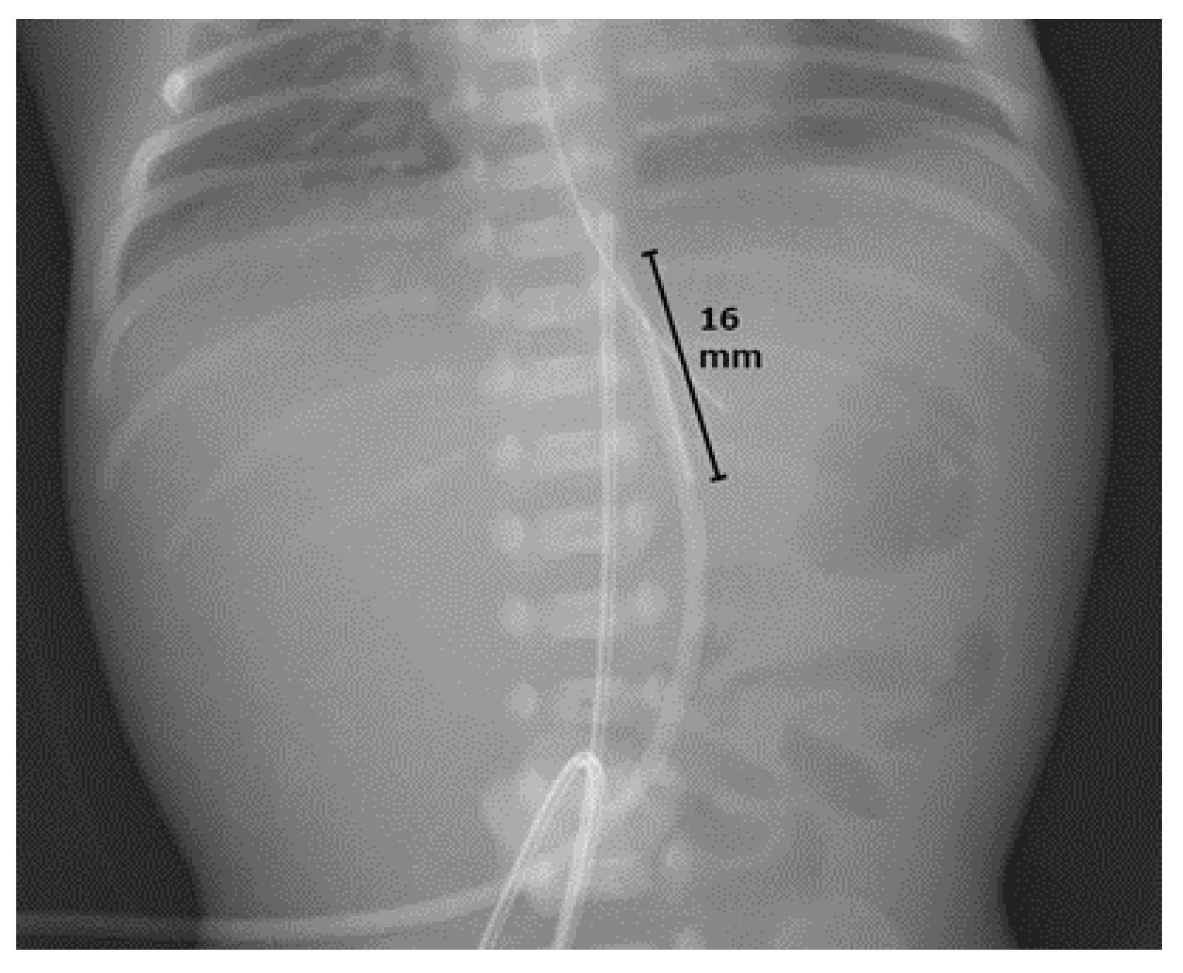 Pediatrrep 16 00007 g001