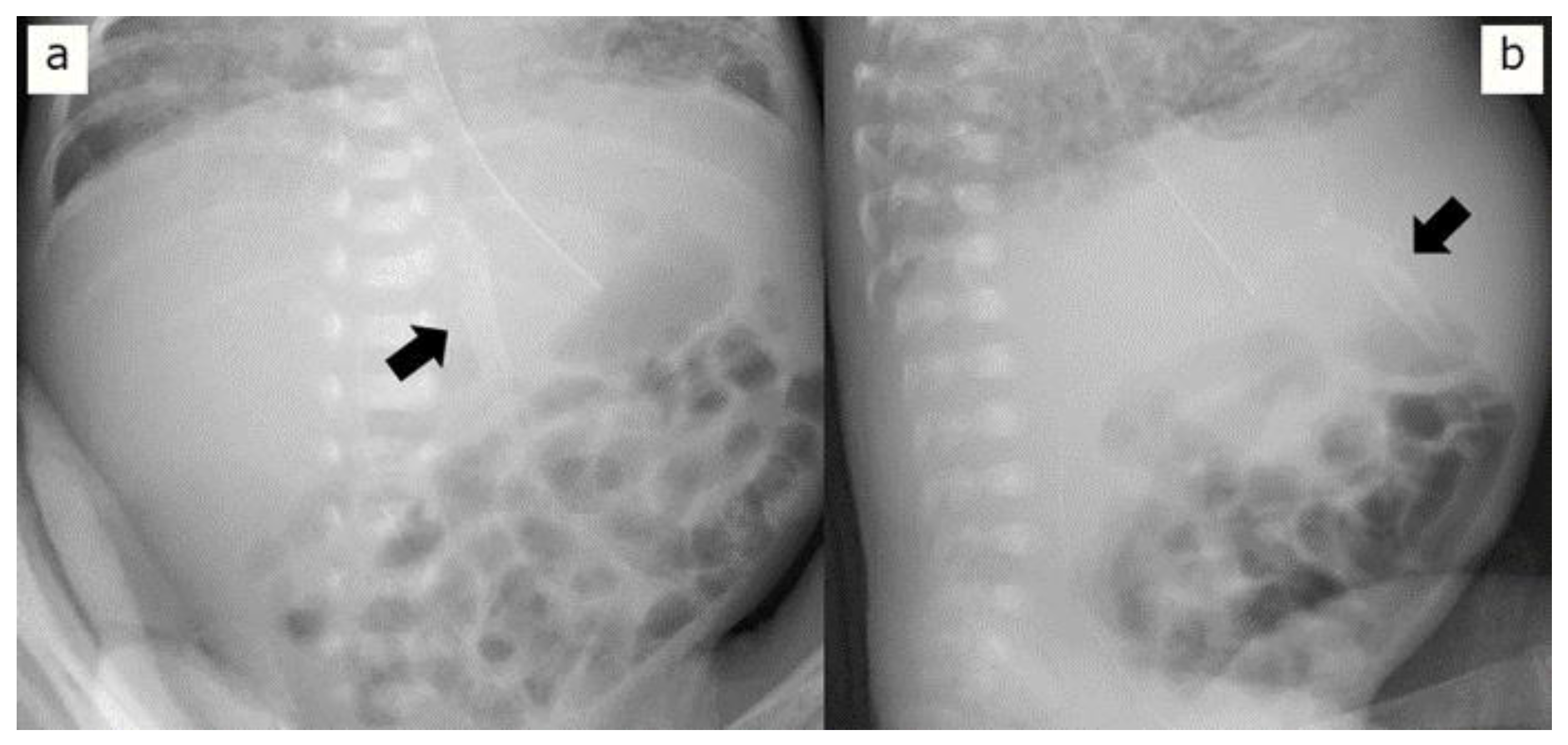 Pediatrrep 16 00007 g002