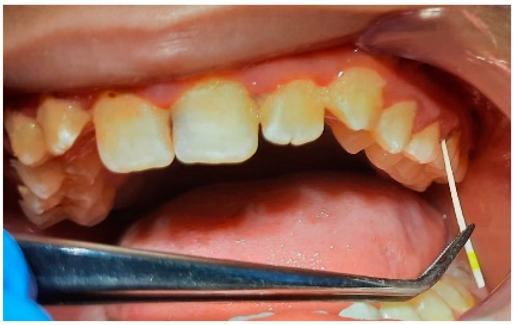 Pediatrrep 16 00041 g007