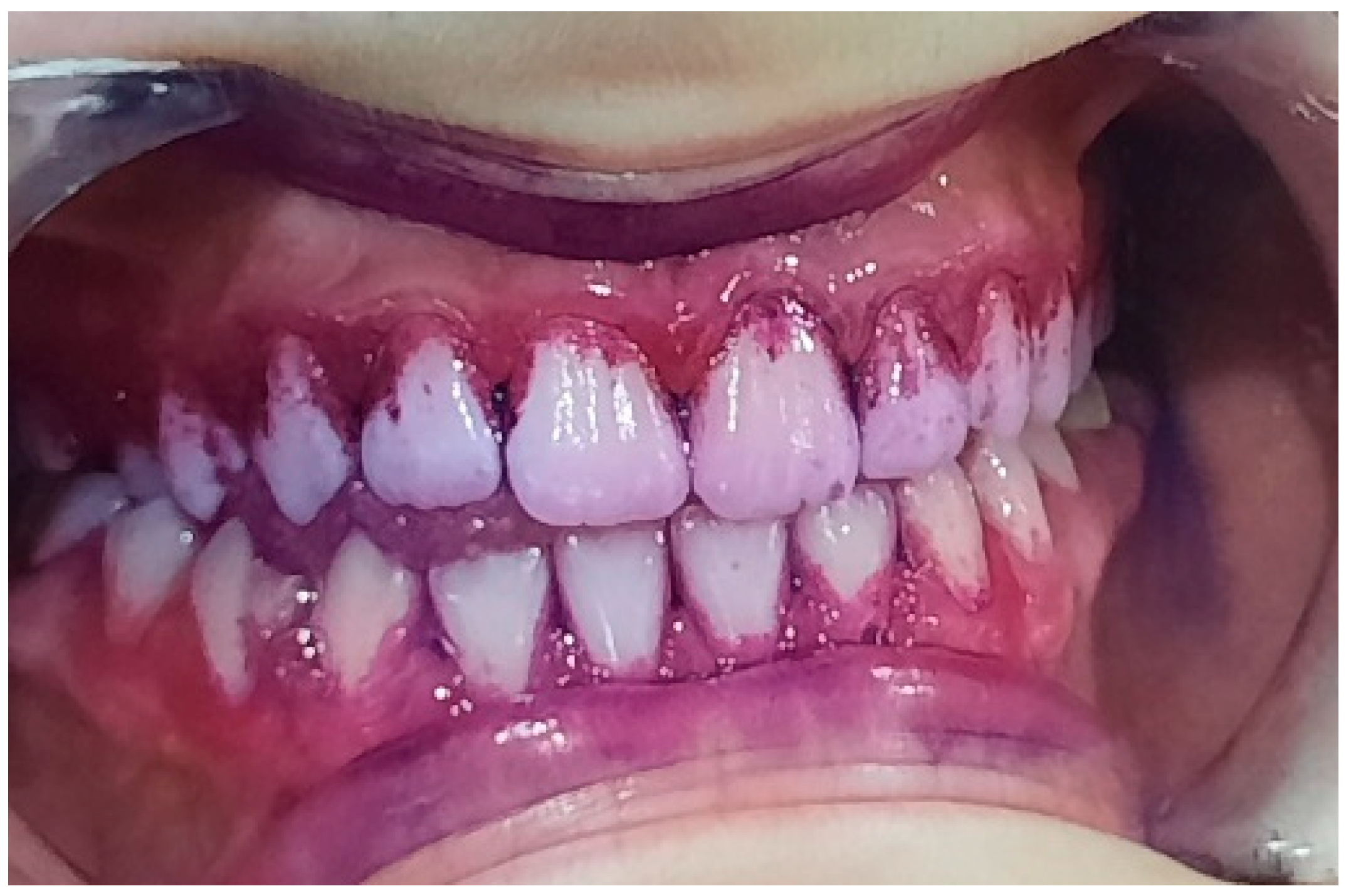 Pediatrrep 16 00041 g011