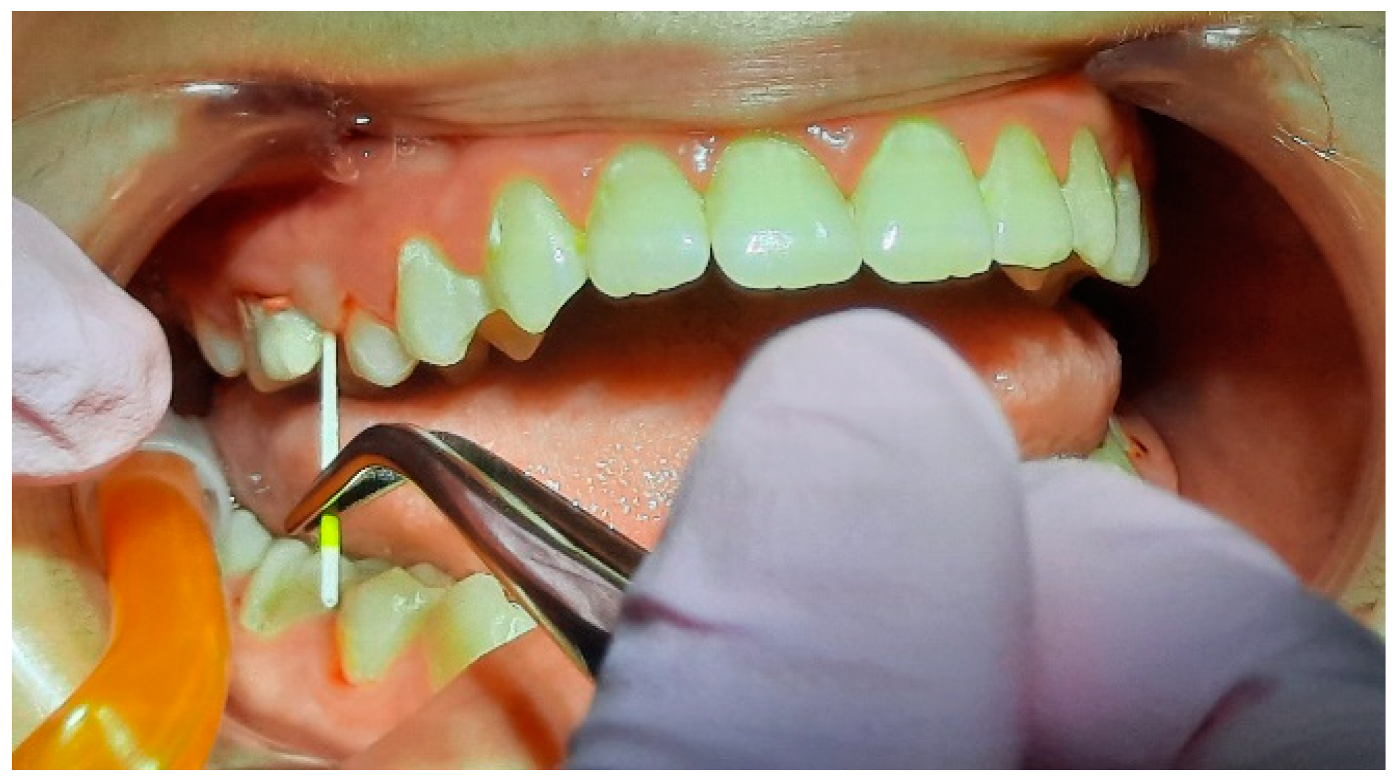 Pediatrrep 16 00041 g012