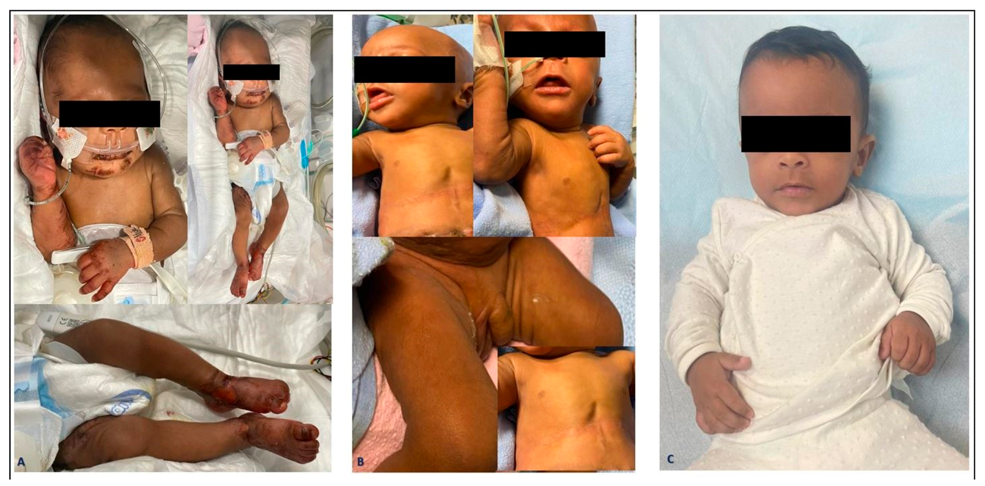 Pediatrrep 16 00046 g002 Pediatrrep 16 00046 g002