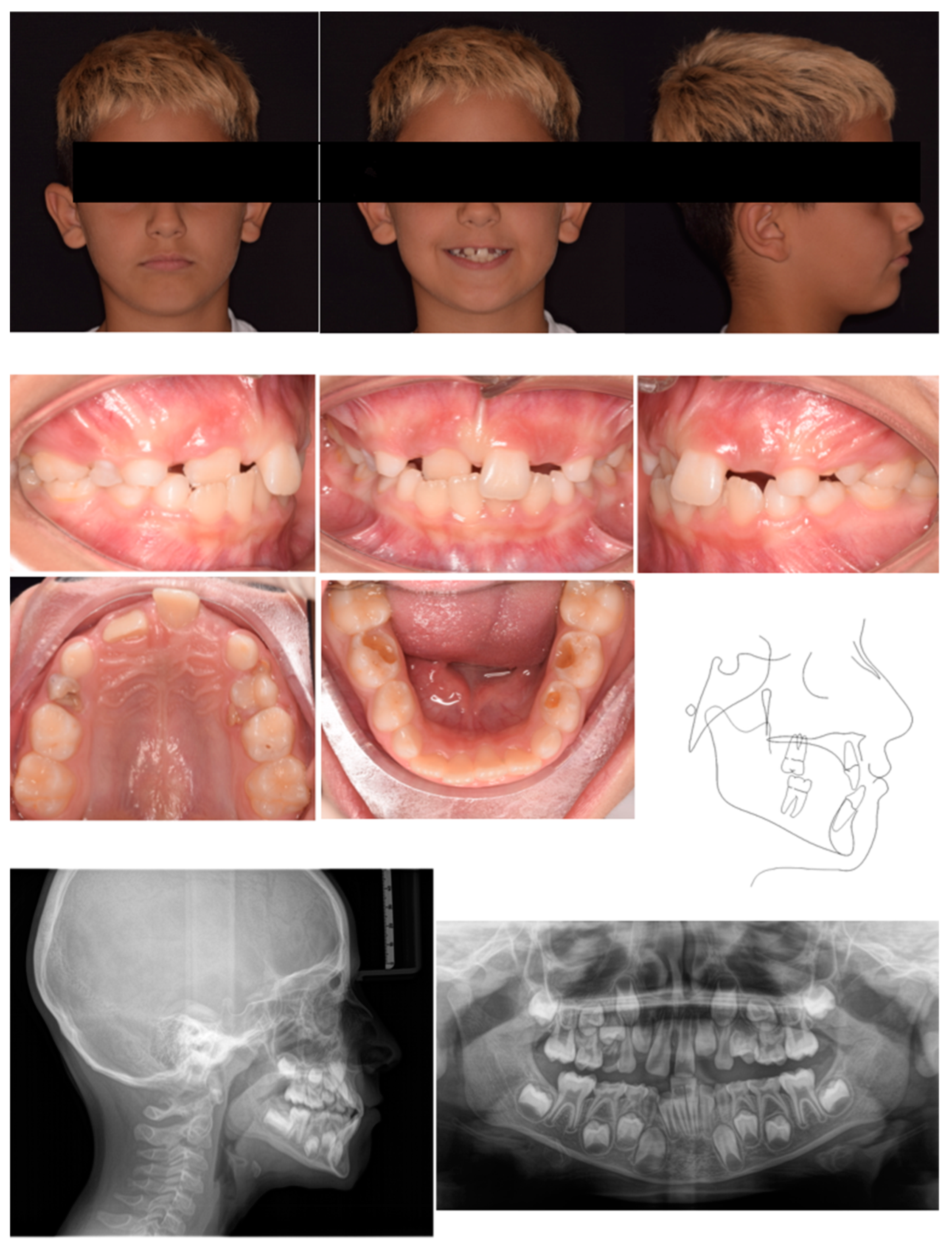 Pediatrrep 17 00011 g001