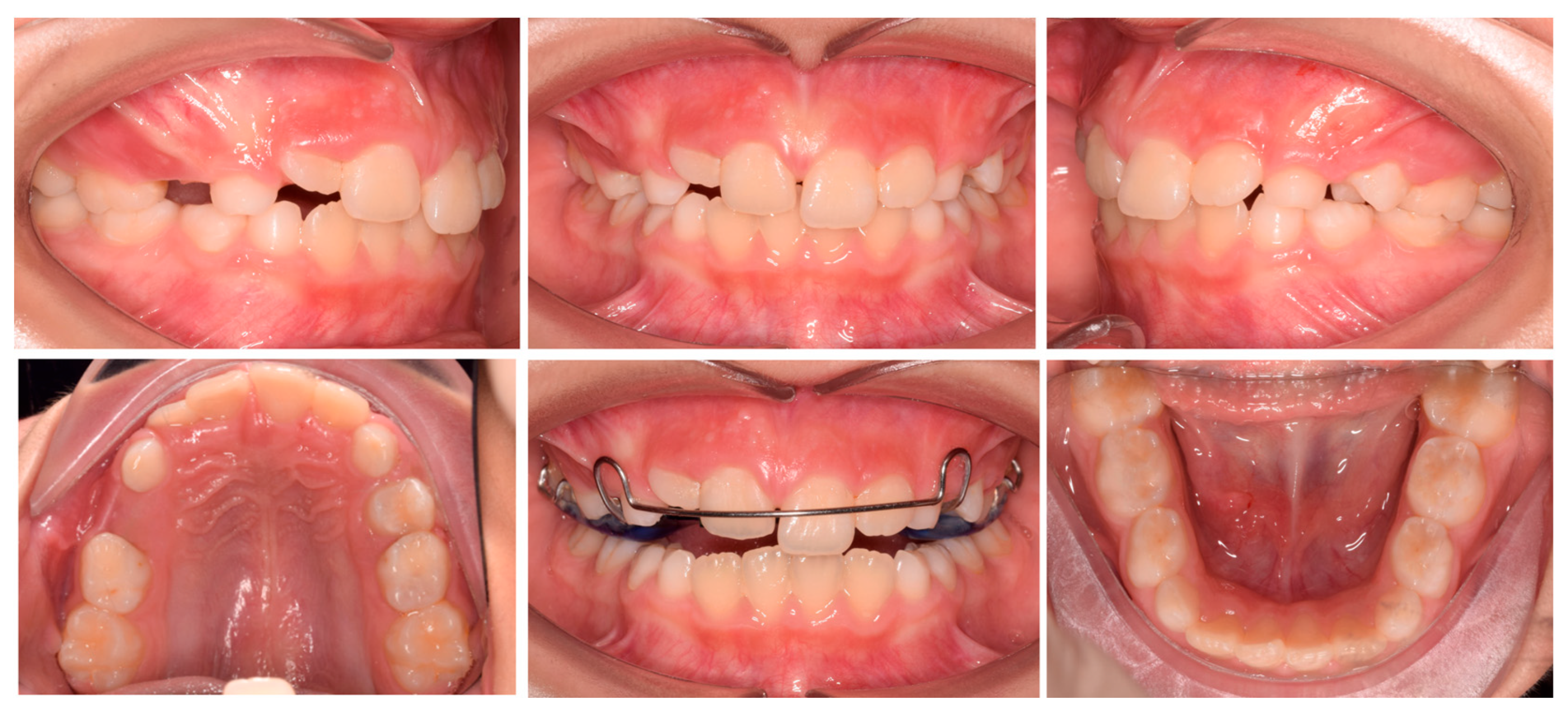 Pediatrrep 17 00011 g003