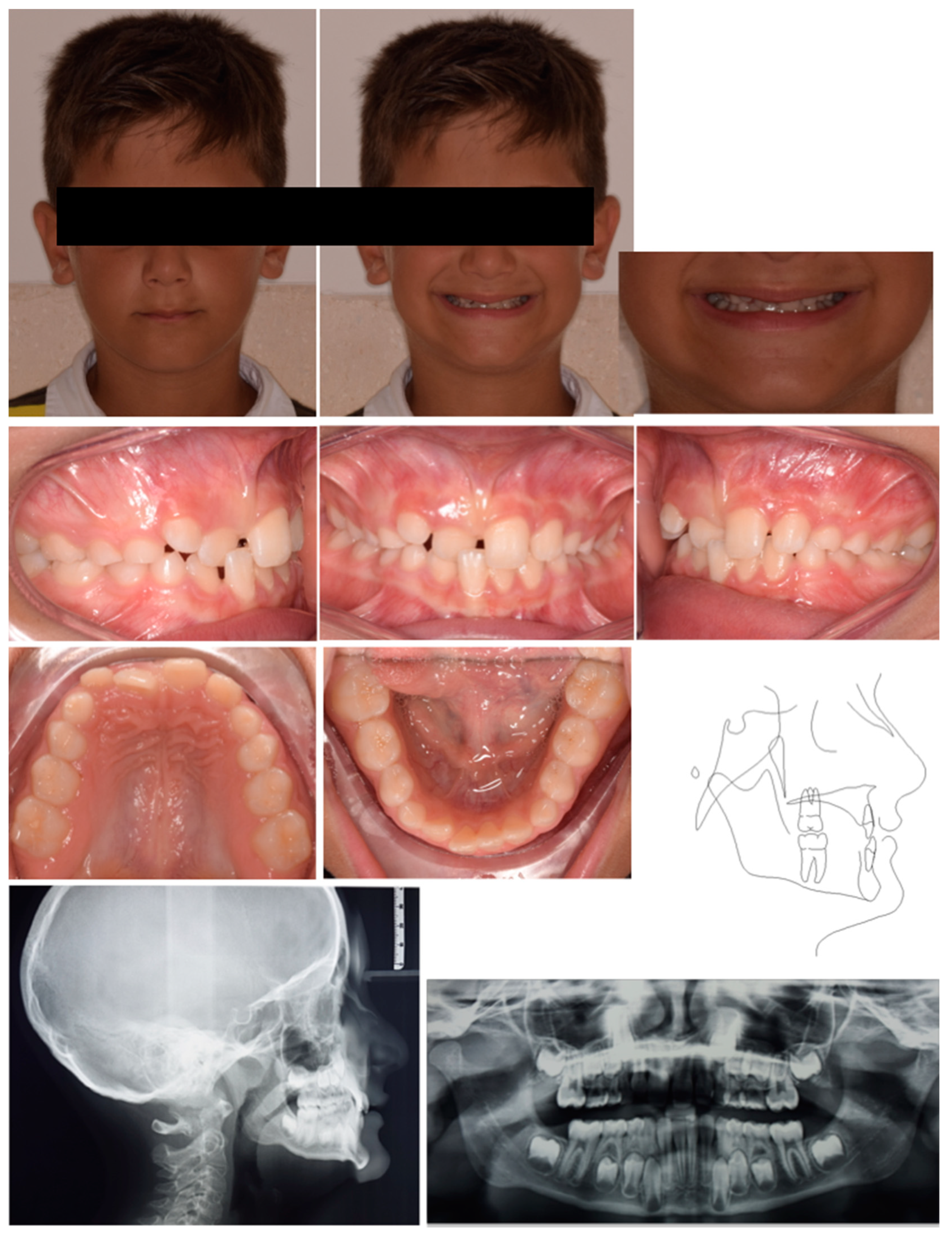 Pediatrrep 17 00011 g005