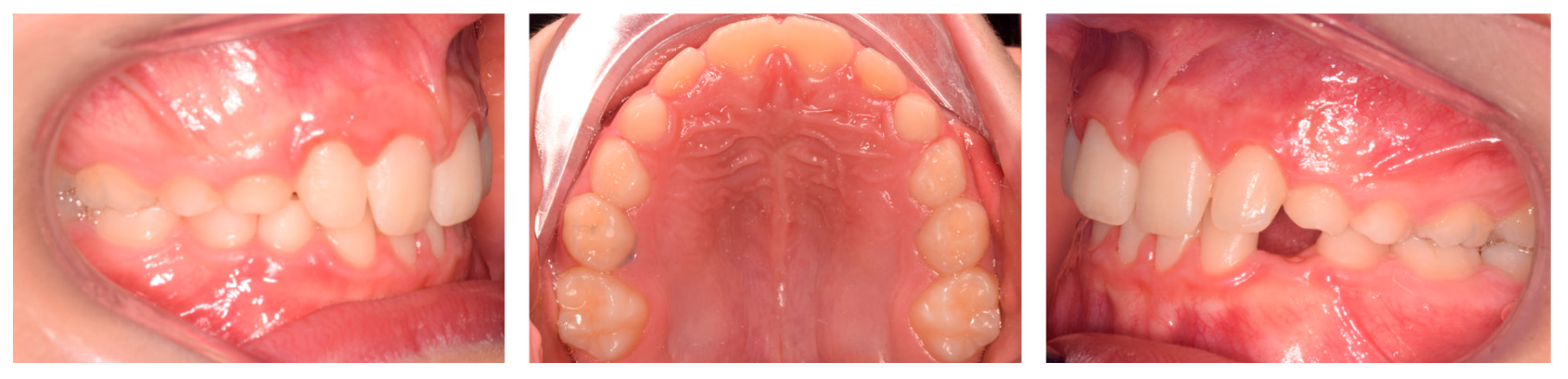 Pediatrrep 17 00011 g007