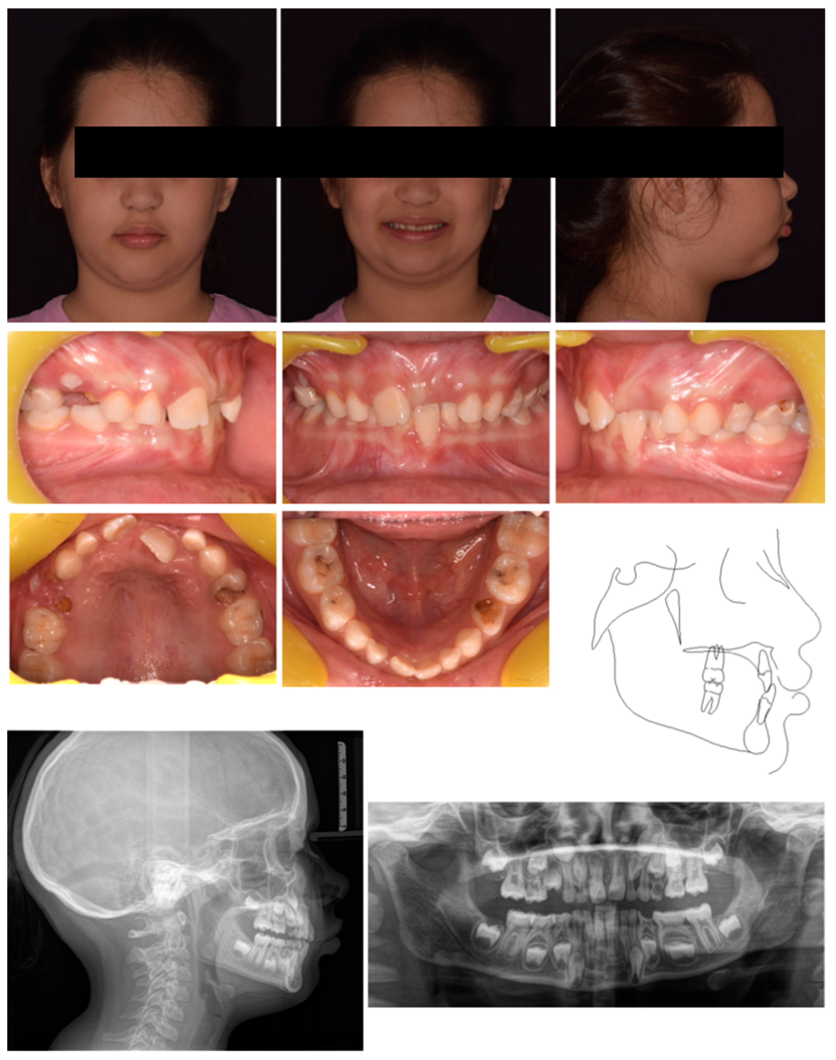 Pediatrrep 17 00011 g008