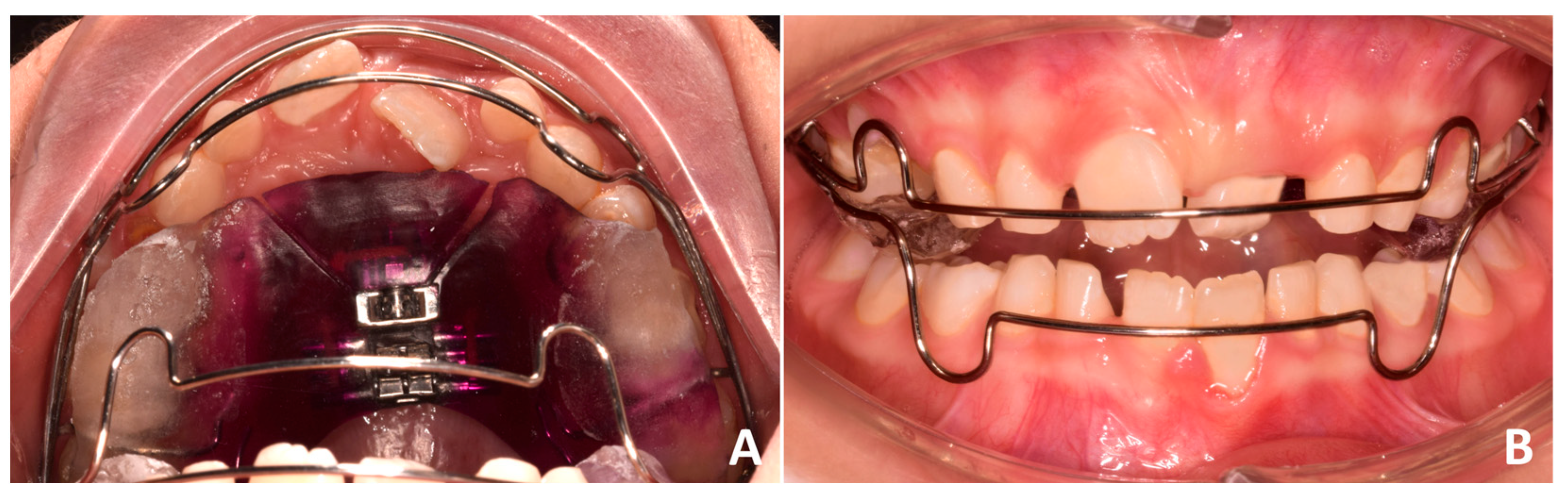 Pediatrrep 17 00011 g009