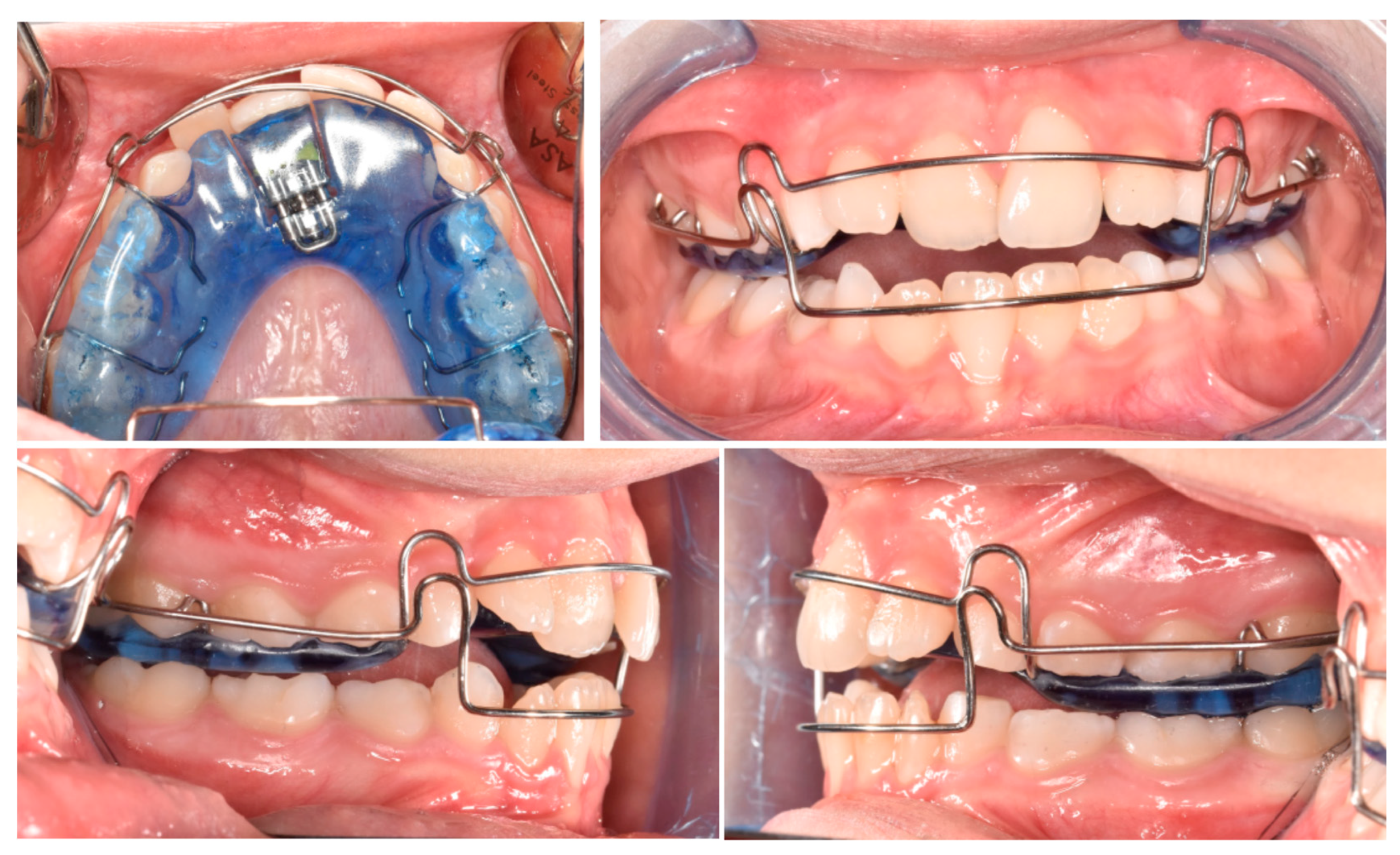 Pediatrrep 17 00011 g013