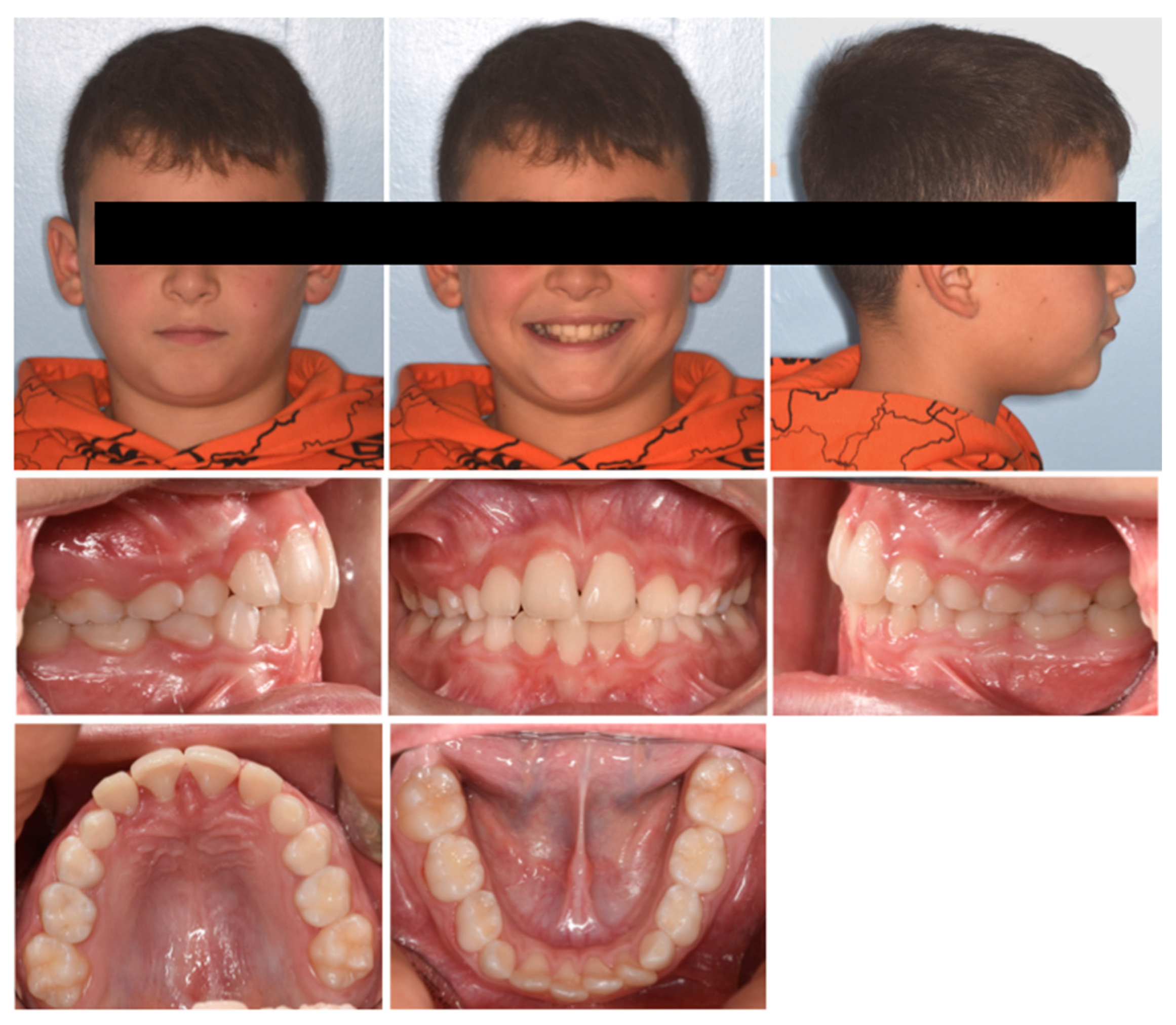 Pediatrrep 17 00011 g014