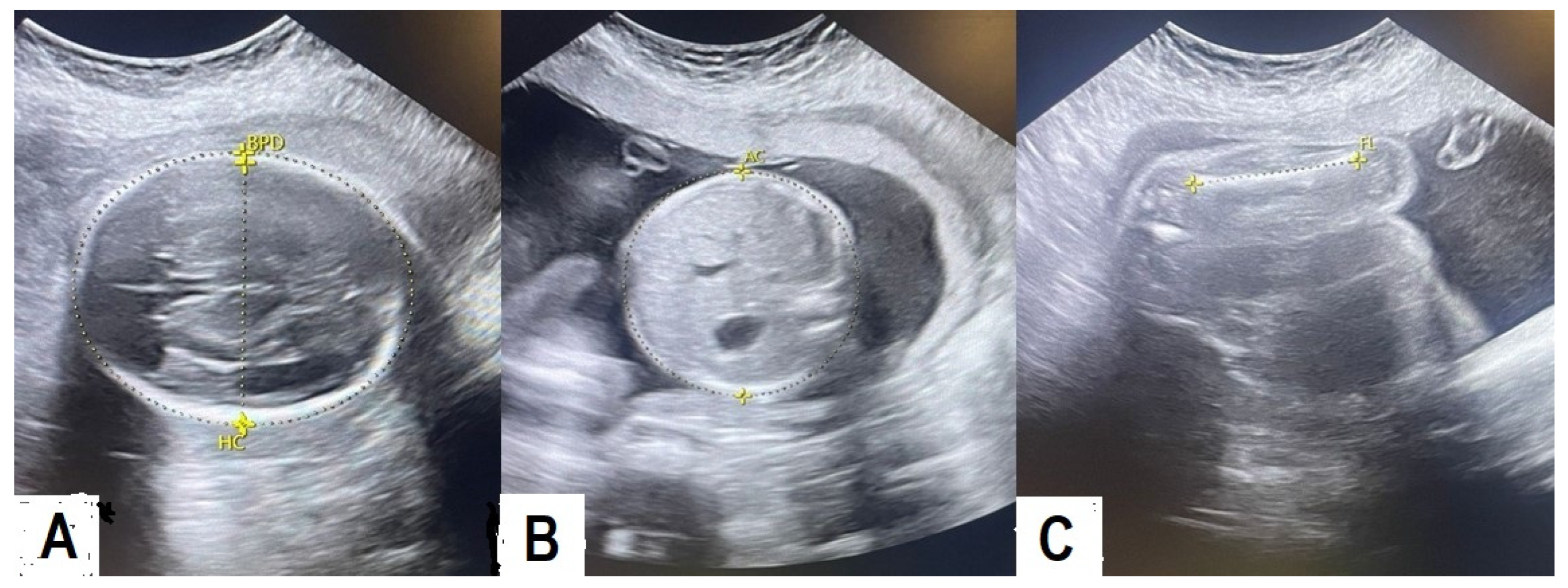 Pediatrrep 17 00070 g001