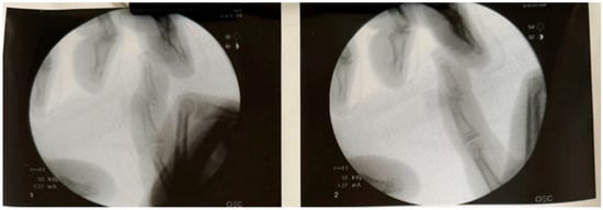 Pediatrrep 17 00082 g004a Pediatrrep 17 00082 g004a