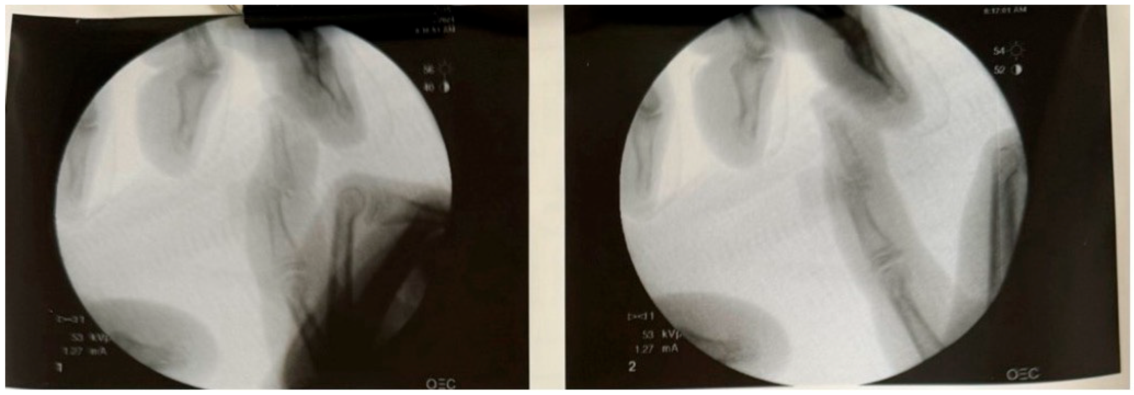 Pediatrrep 17 00082 g004a Pediatrrep 17 00082 g004a