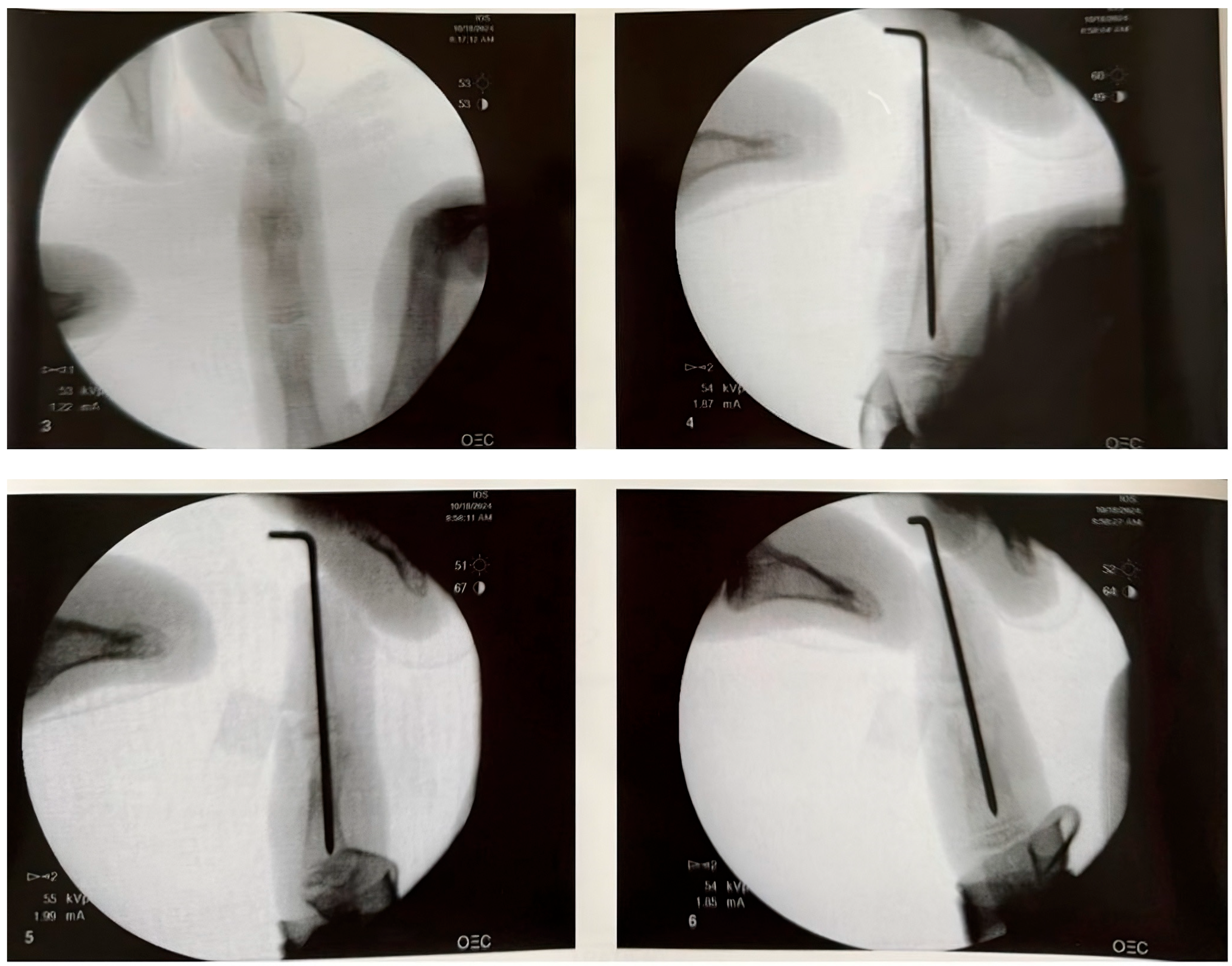 Pediatrrep 17 00082 g004b Pediatrrep 17 00082 g004b