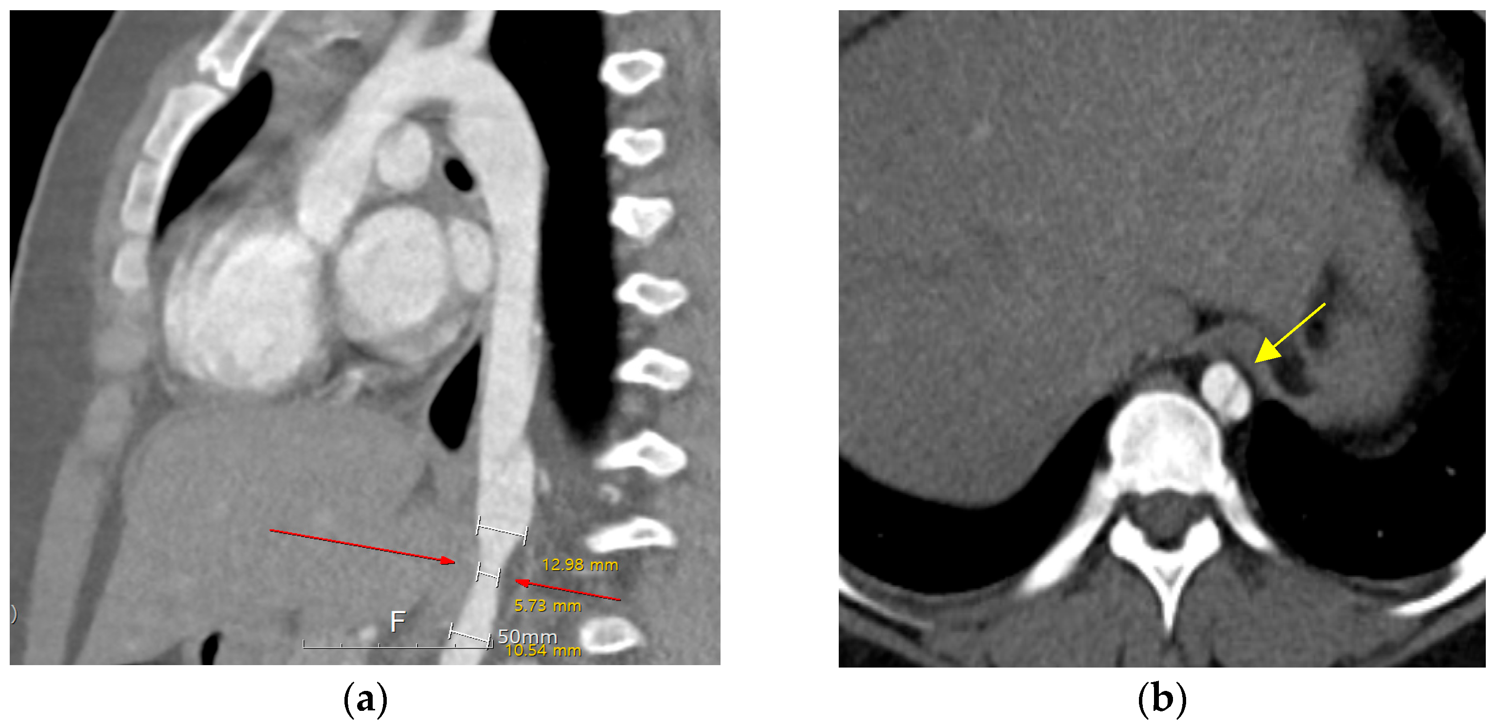 Pediatrrep 17 00084 g001 Pediatrrep 17 00084 g001