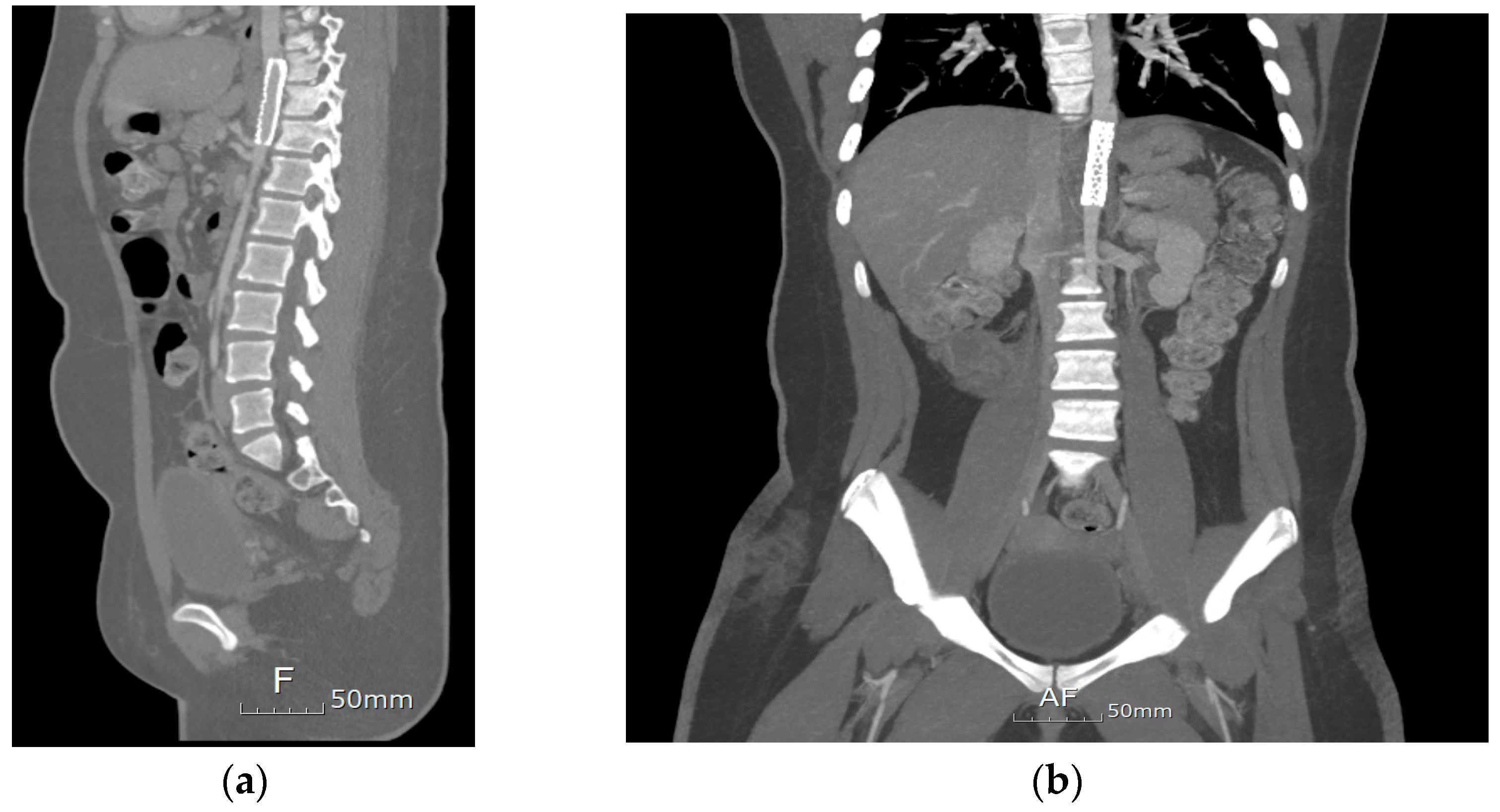 Pediatrrep 17 00084 g003 Pediatrrep 17 00084 g003