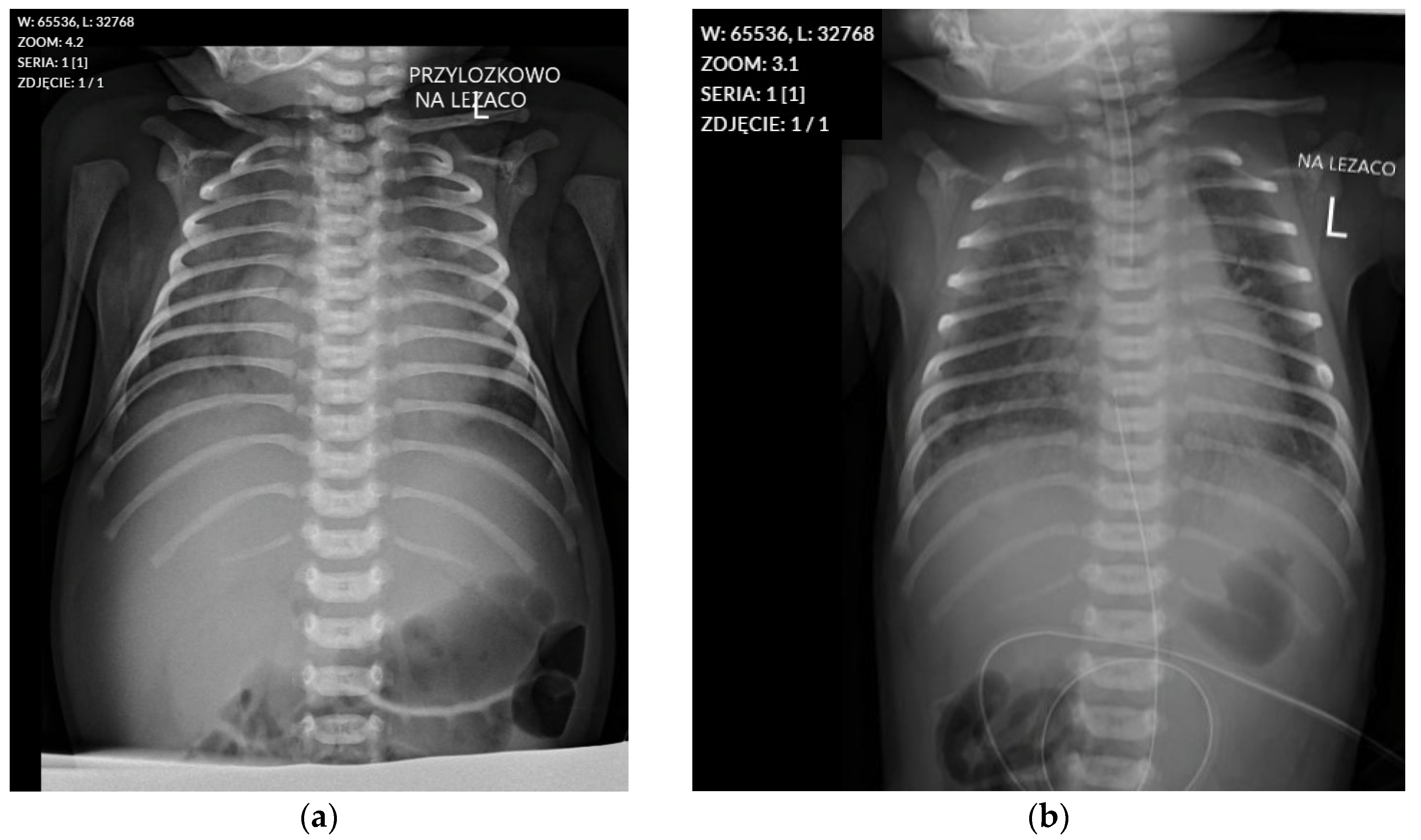 Pediatrrep 17 00086 g0a1