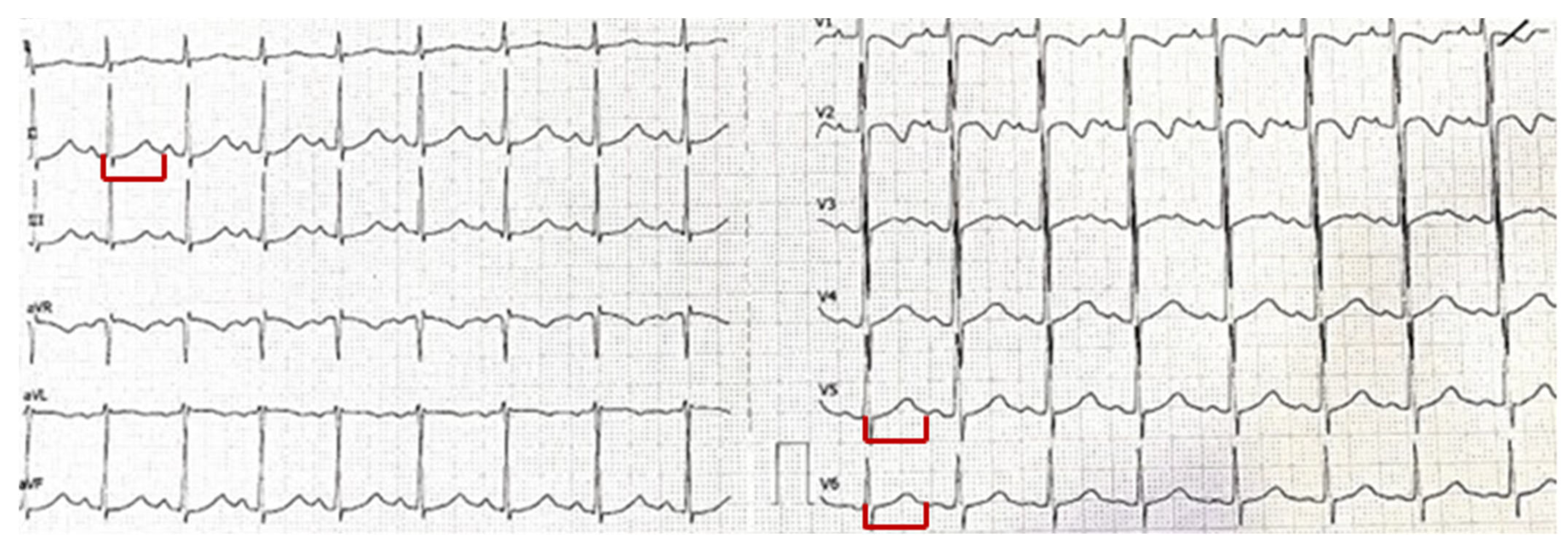 Pediatrrep 17 00087 g001
