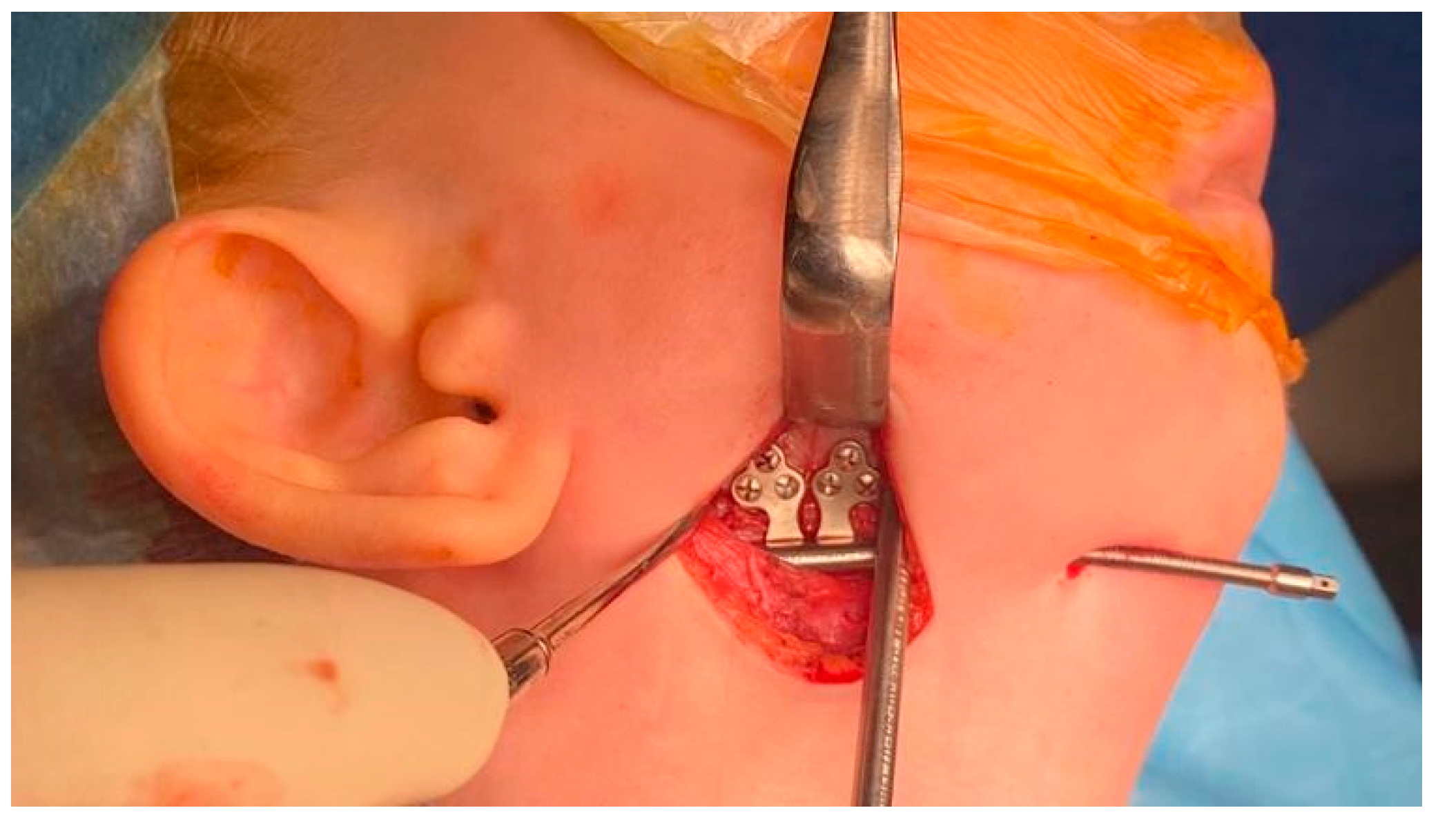 Pediatrrep 18 00006 g004 Pediatrrep 18 00006 g004